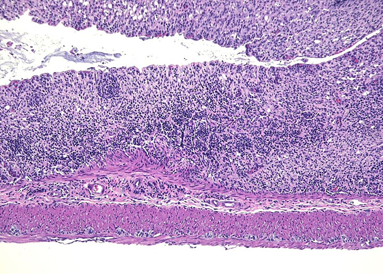 Protein reins in intestinal inflammation by curbing an overactive immune signal