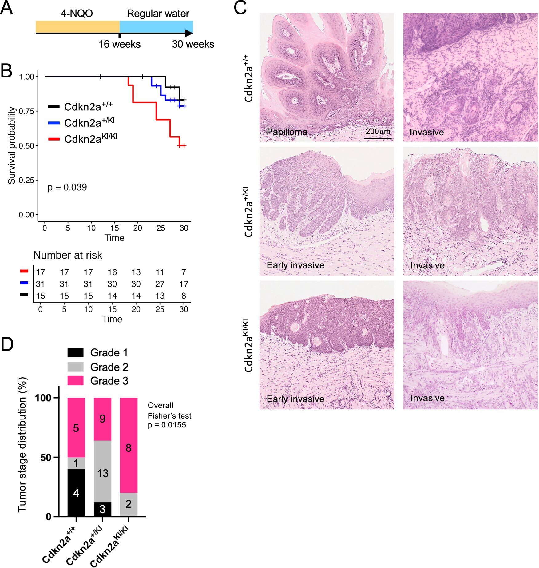 Tumor suppressor gene mutations trigger immune activation in early oral cancer