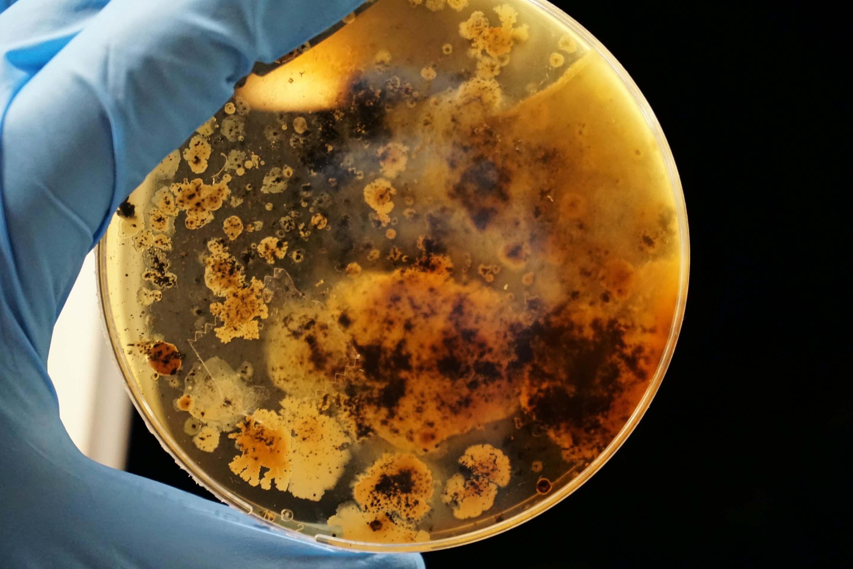Q&A: Expert discusses Russian plague scare
