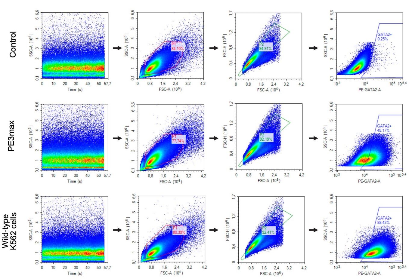 Prime editing repairs immune disorder defect in patient's own blood stem cells