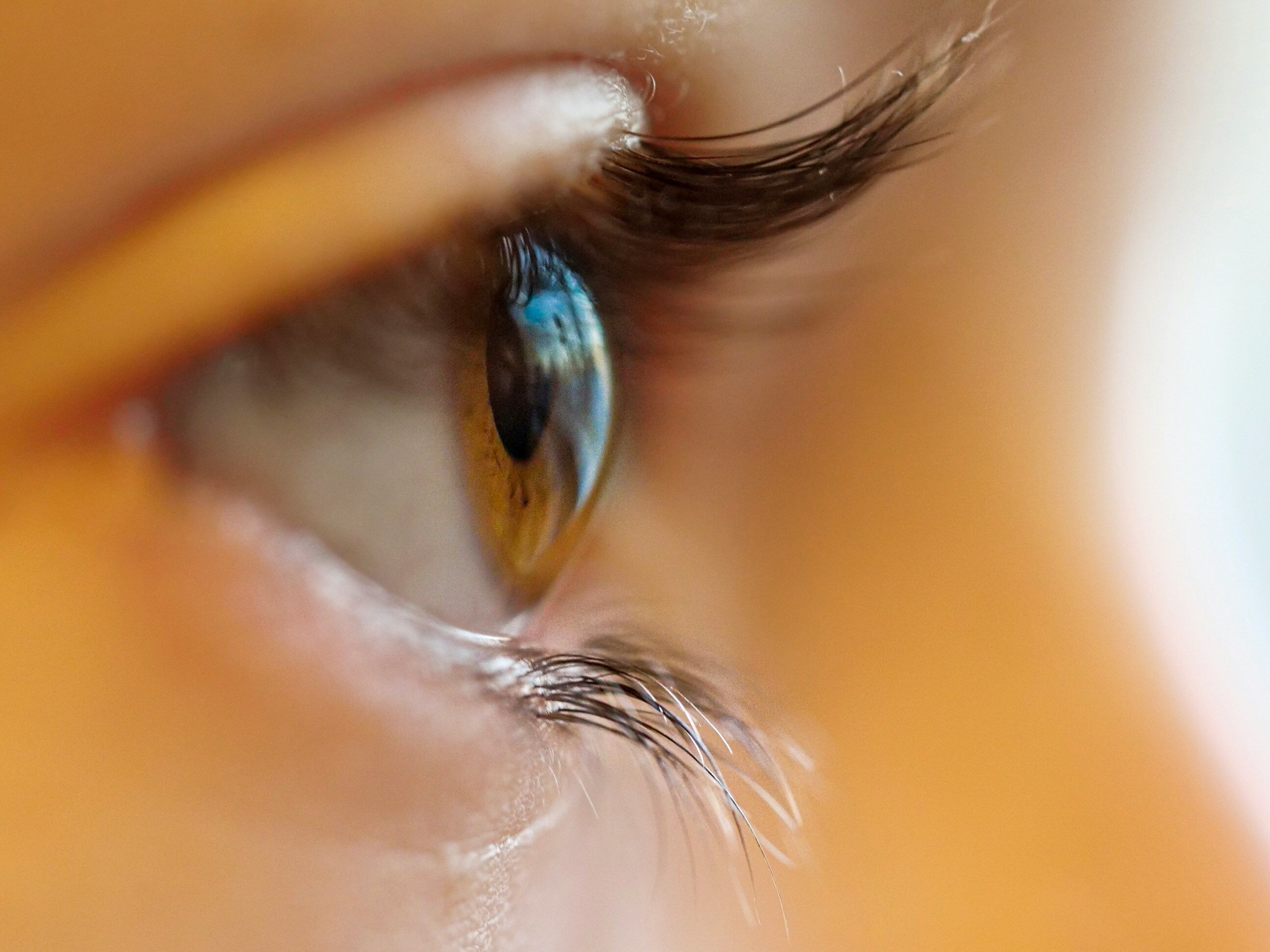 Experimental cataract lens can treat glaucoma through time-release drugs