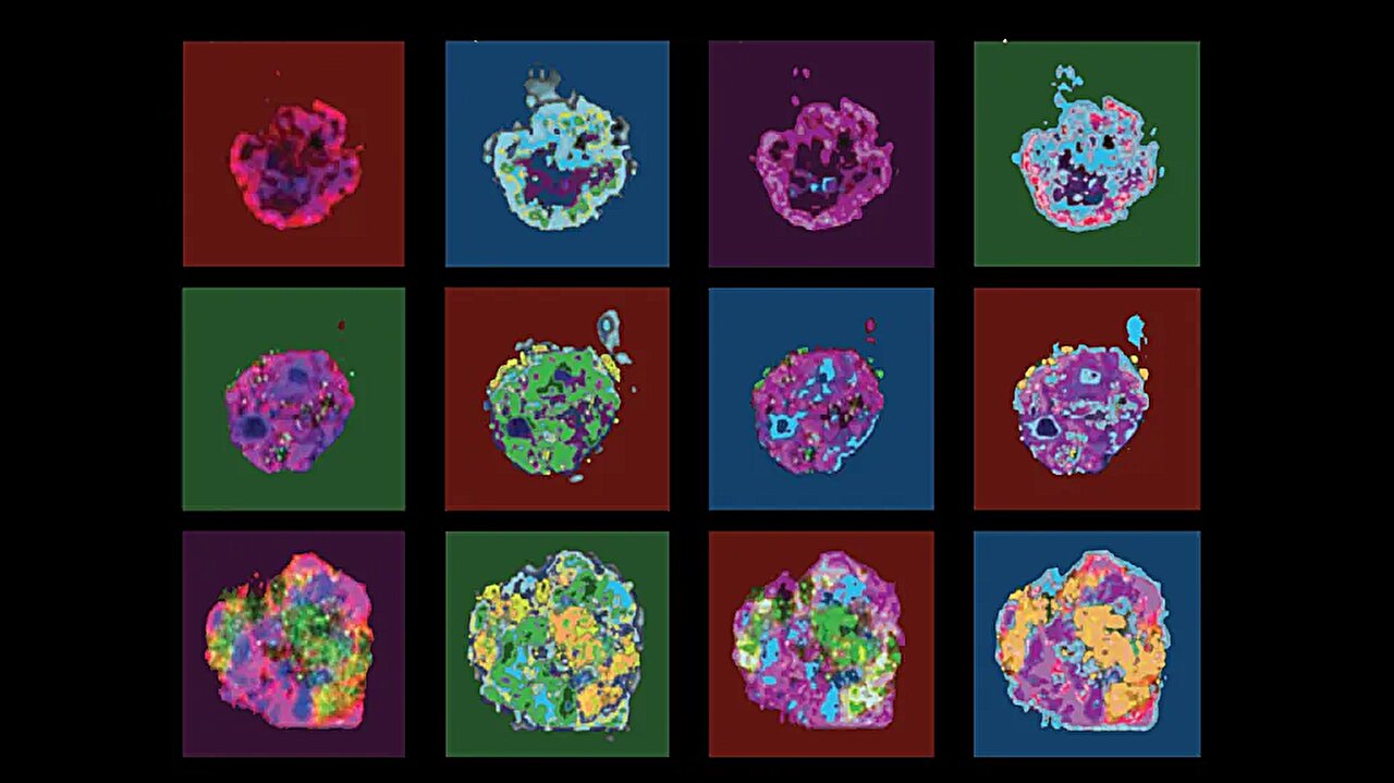 How a common virus's hijack of cell repair processes may promote cancer