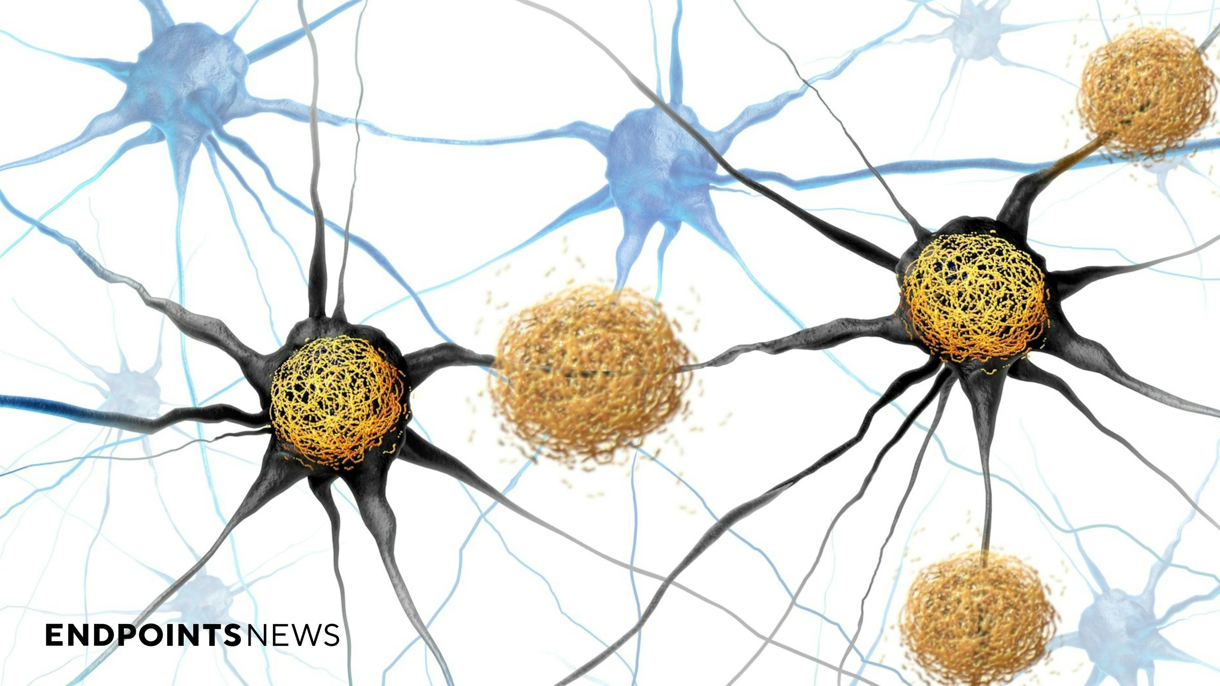 Arrowhead’s brain-targeting RNA drug lowers Alzheimer’s protein in early study