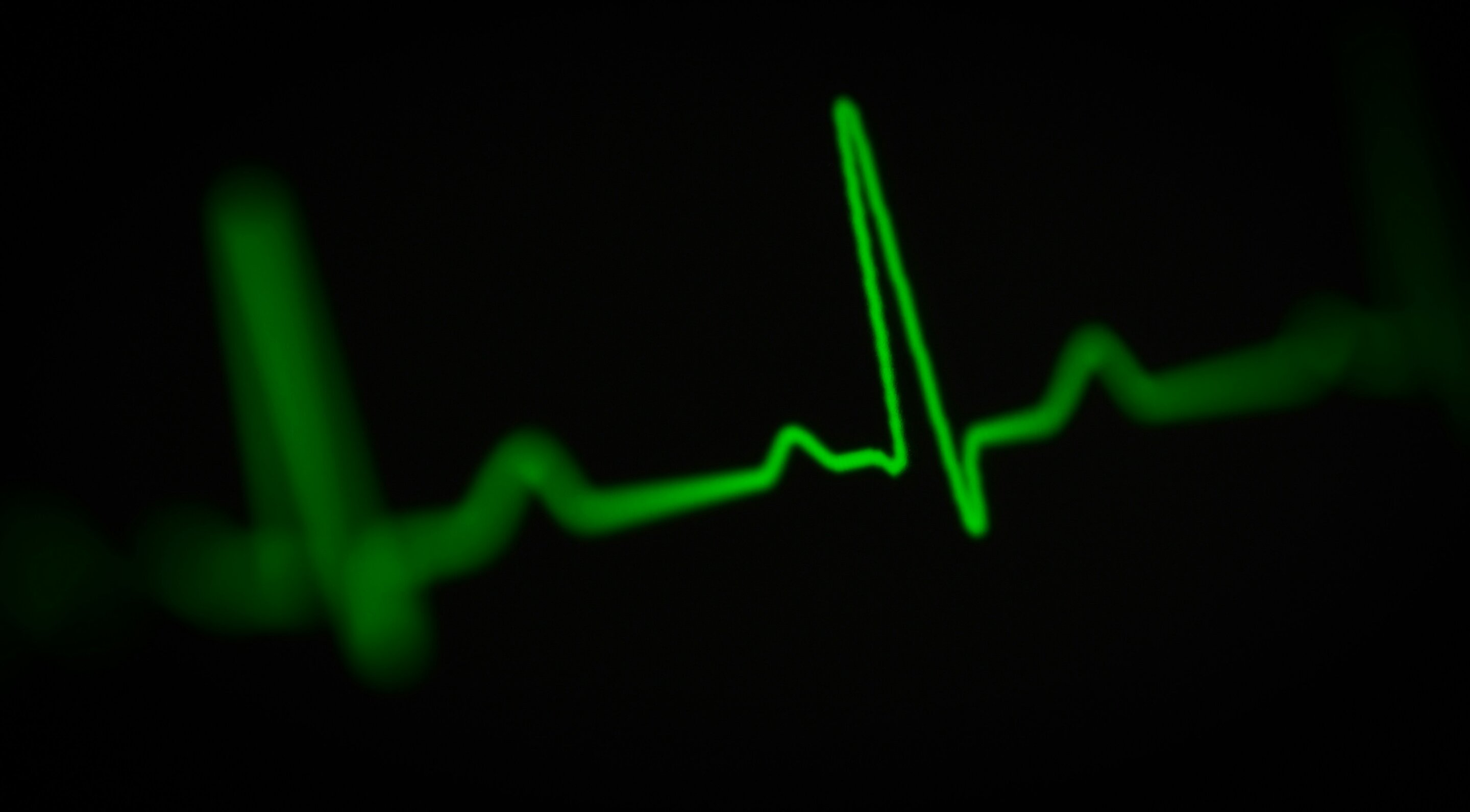 Inflammation is already elevated at the earliest stage of cardiovascular-kidney-metabolic syndrome