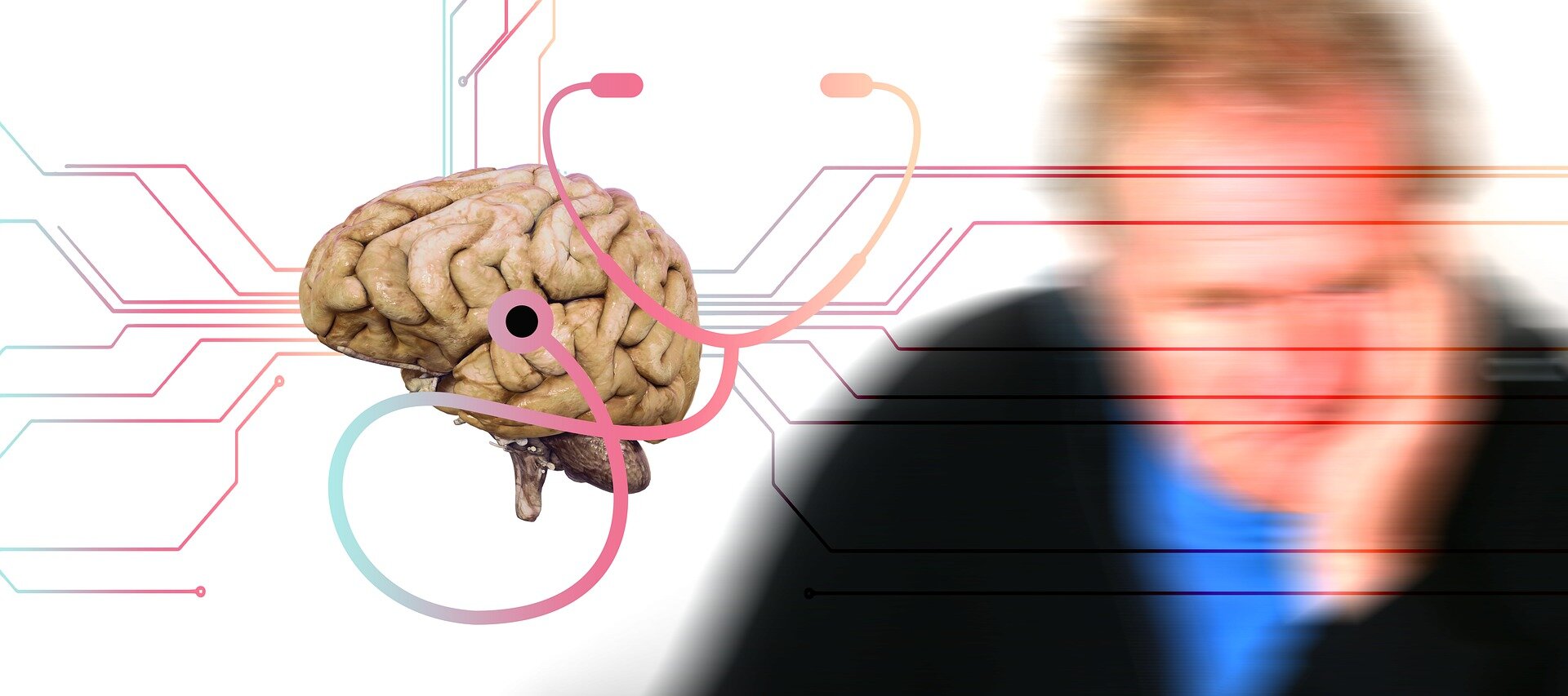 Molecular glue degraders show early promise in reducing Alzheimer's-linked brain plaques