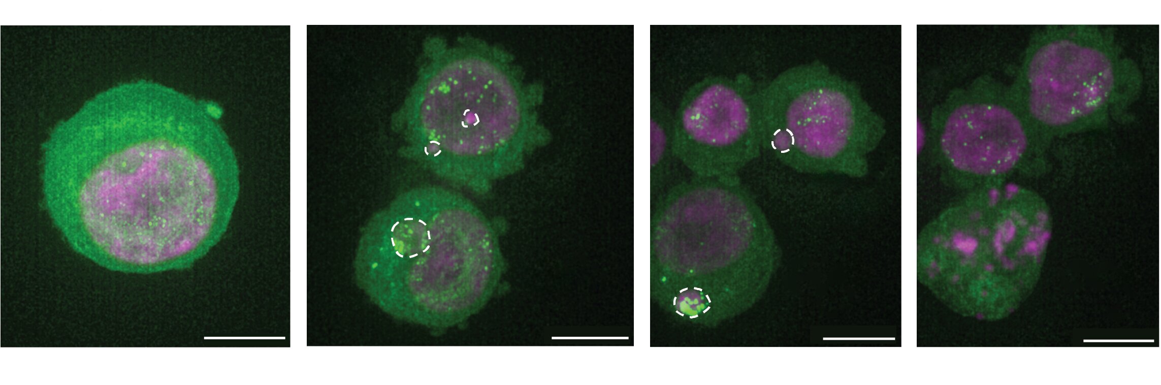 Trapping cancer-driving DNA rings outside cell nucleus silences their genes, researchers find