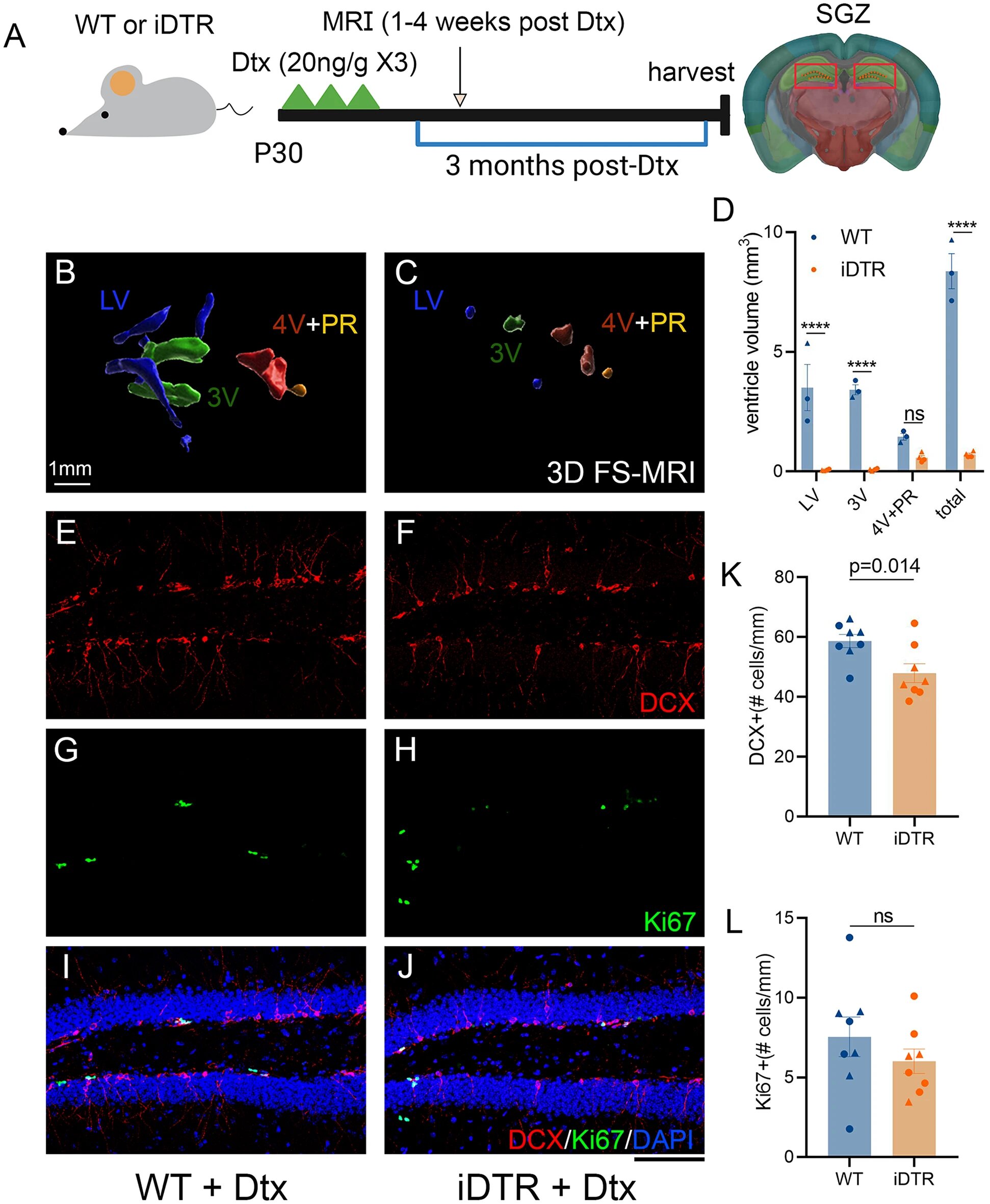 Experimental gene therapy shows promise against hydrocephalus