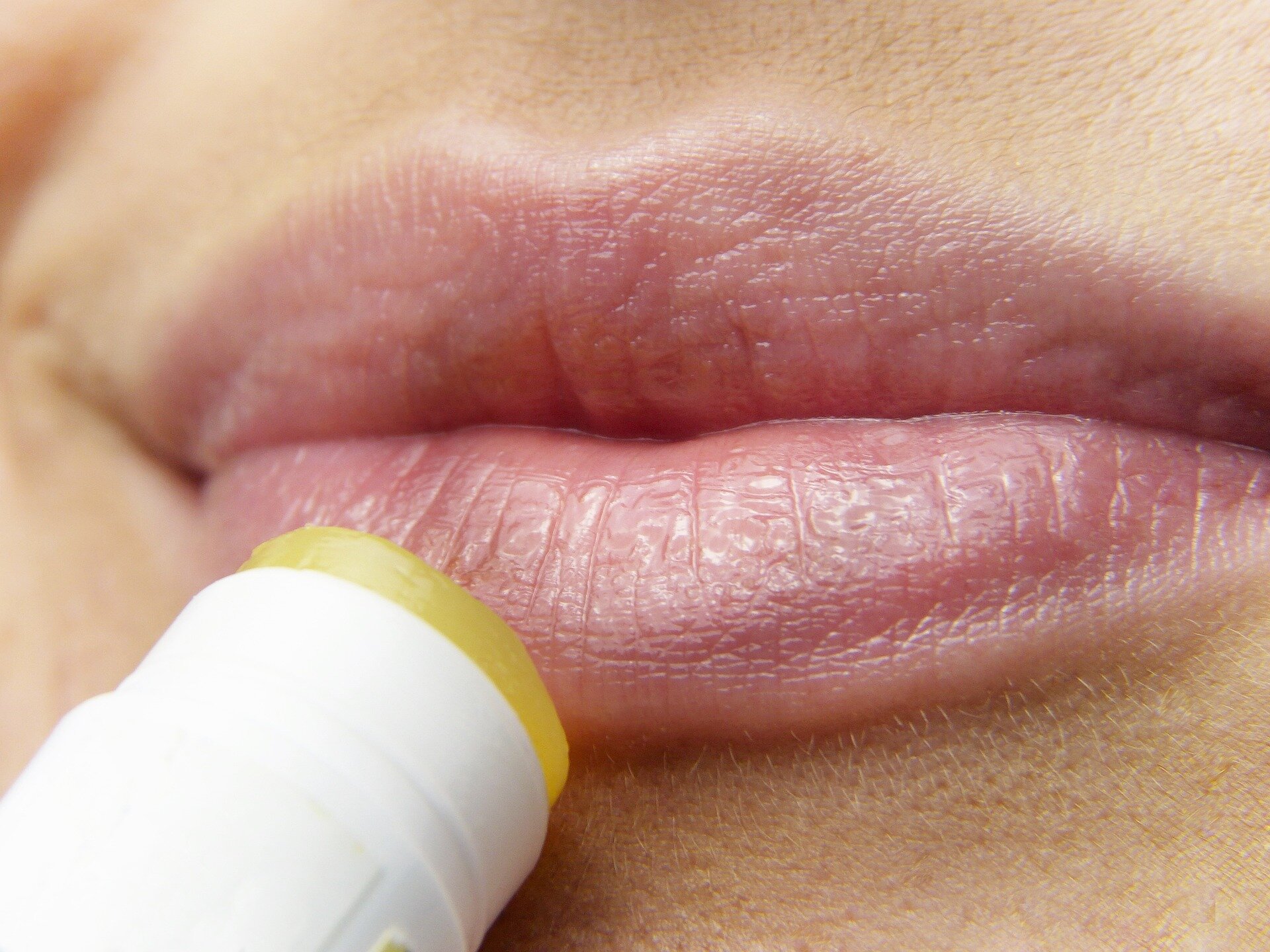 Herpes 'remedies' sold on Amazon and Walmart pose public health risk, FDA warns