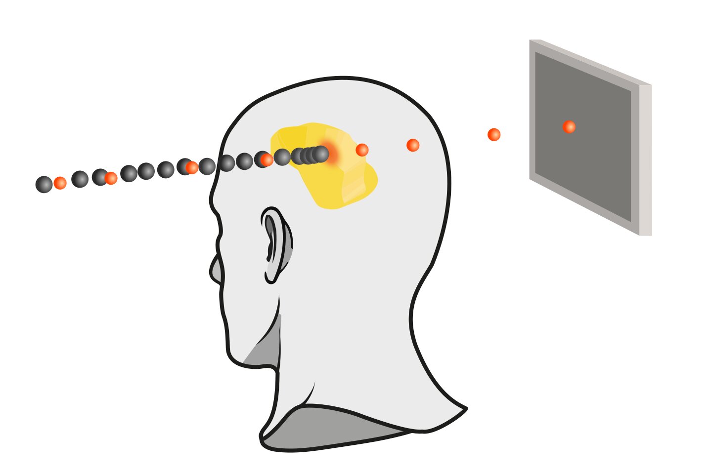 Mixed beam measurement method could help make ion cancer therapy more precise