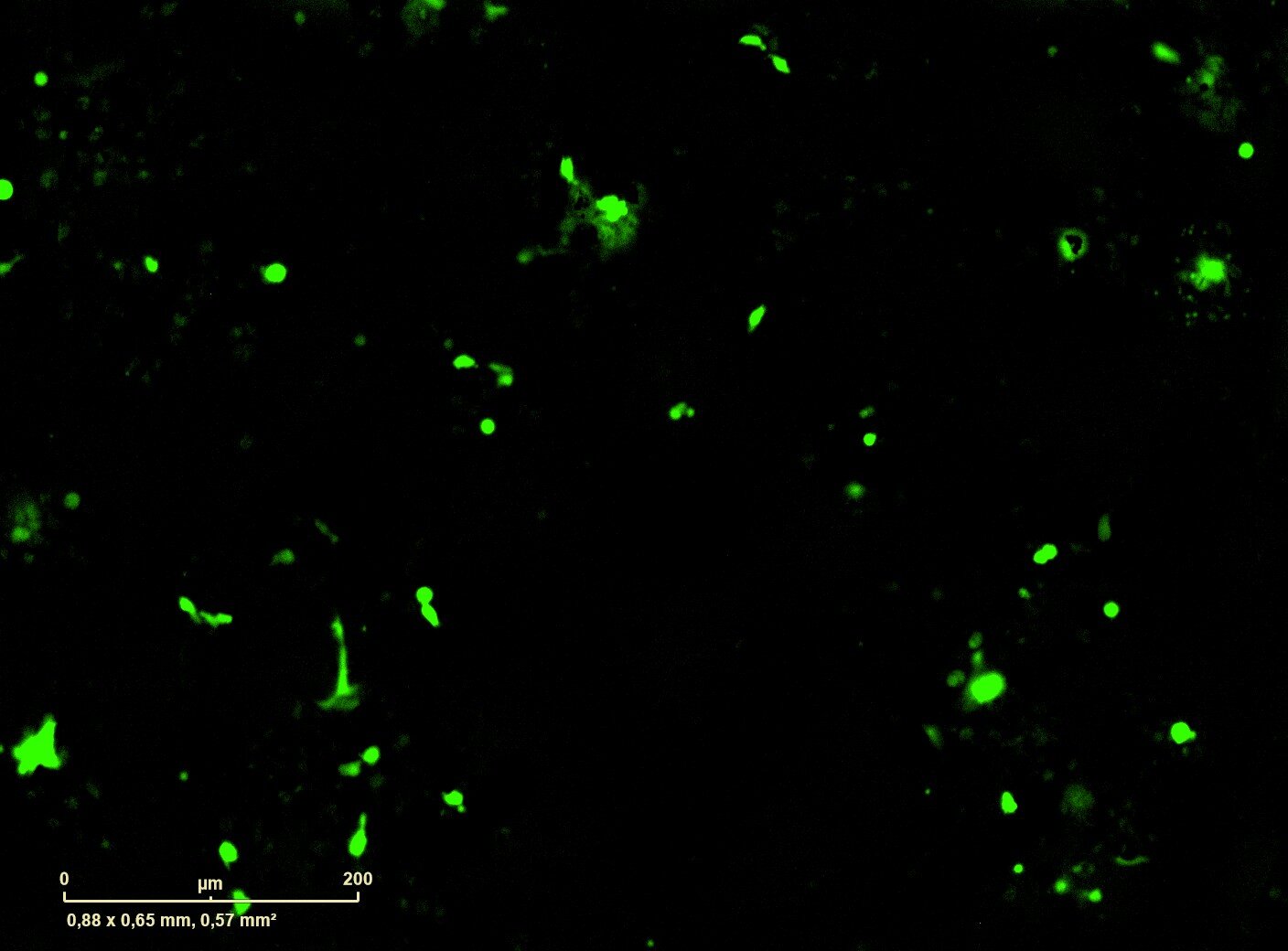 Reversible genetic switches could give cancer immunotherapy more precise control