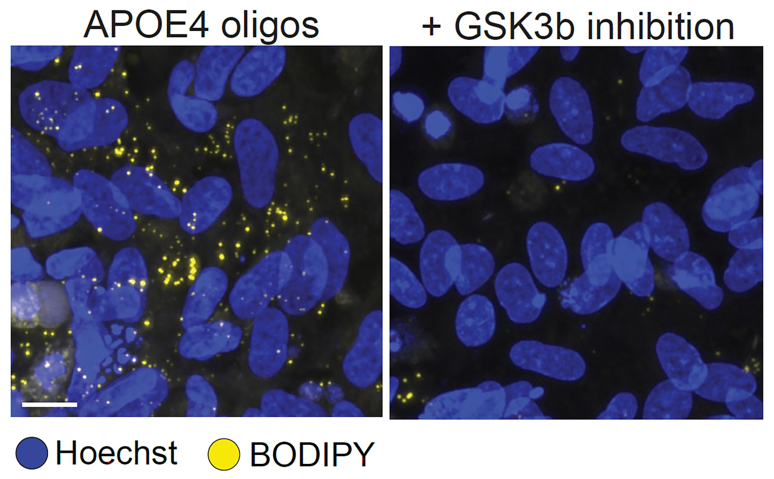 How the biggest Alzheimer's risk gene disrupts the process of insulating neurons