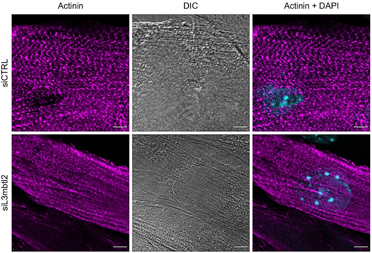 Protein modification partially reverses cancer-related muscle wasting in preclinical study