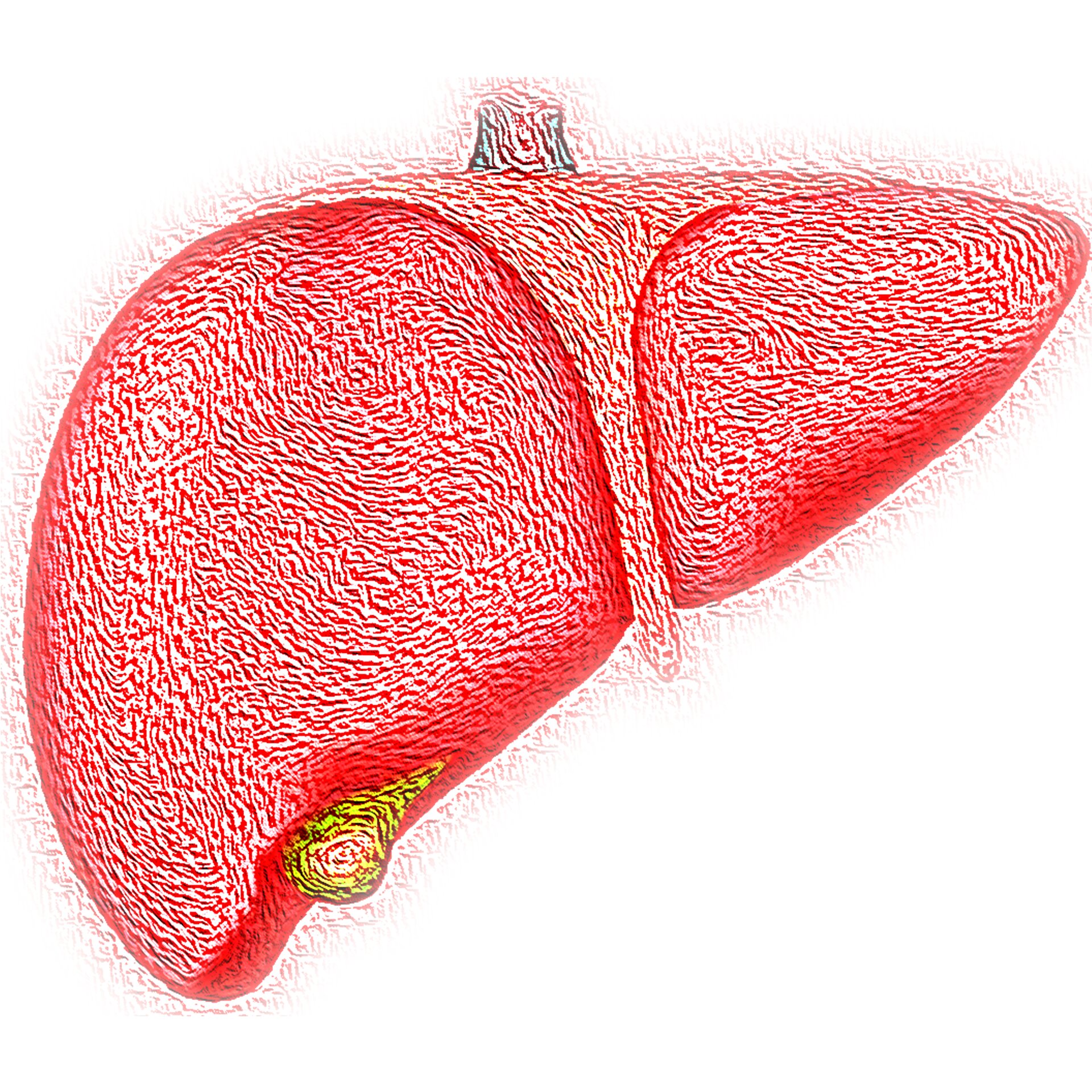 Recommendations developed for preventive care in cirrhosis