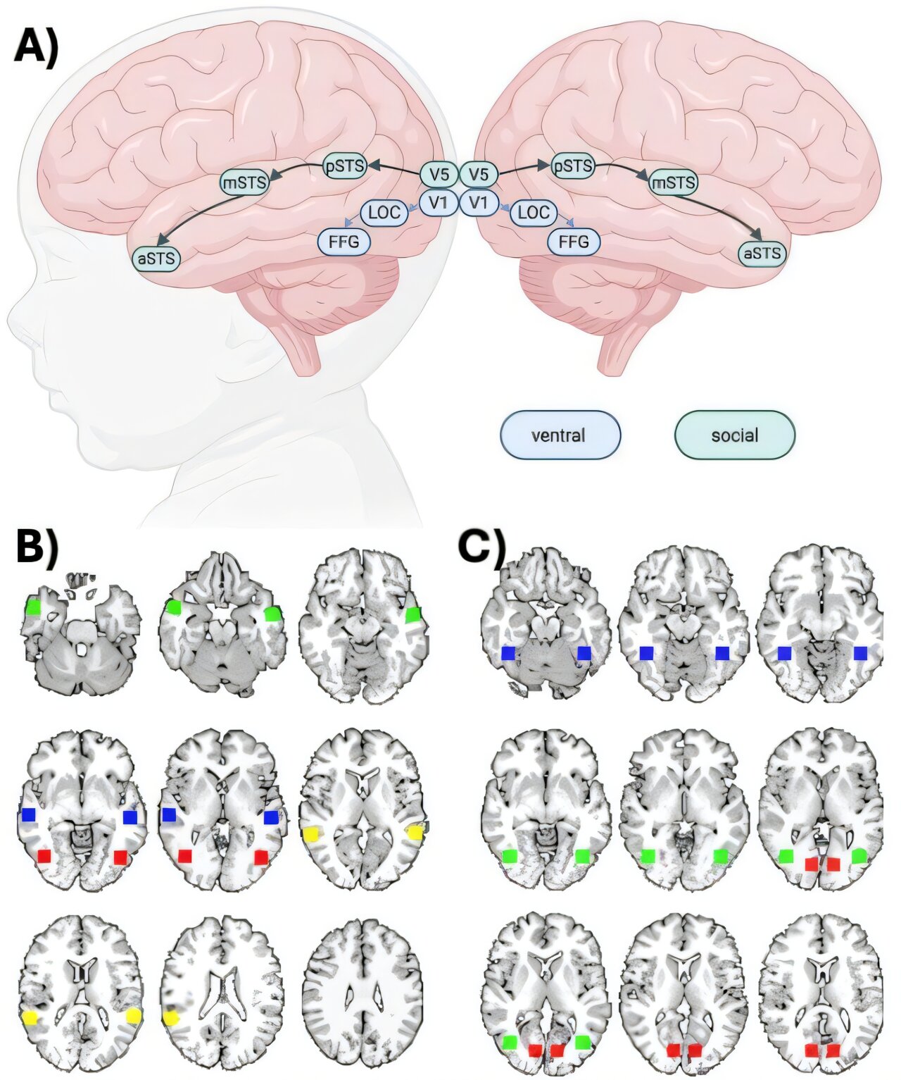 The brain gears up for processing faces well before birth