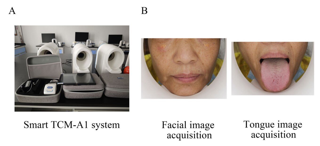 AI detects coronary heart disease from face and tongue photos in small test
