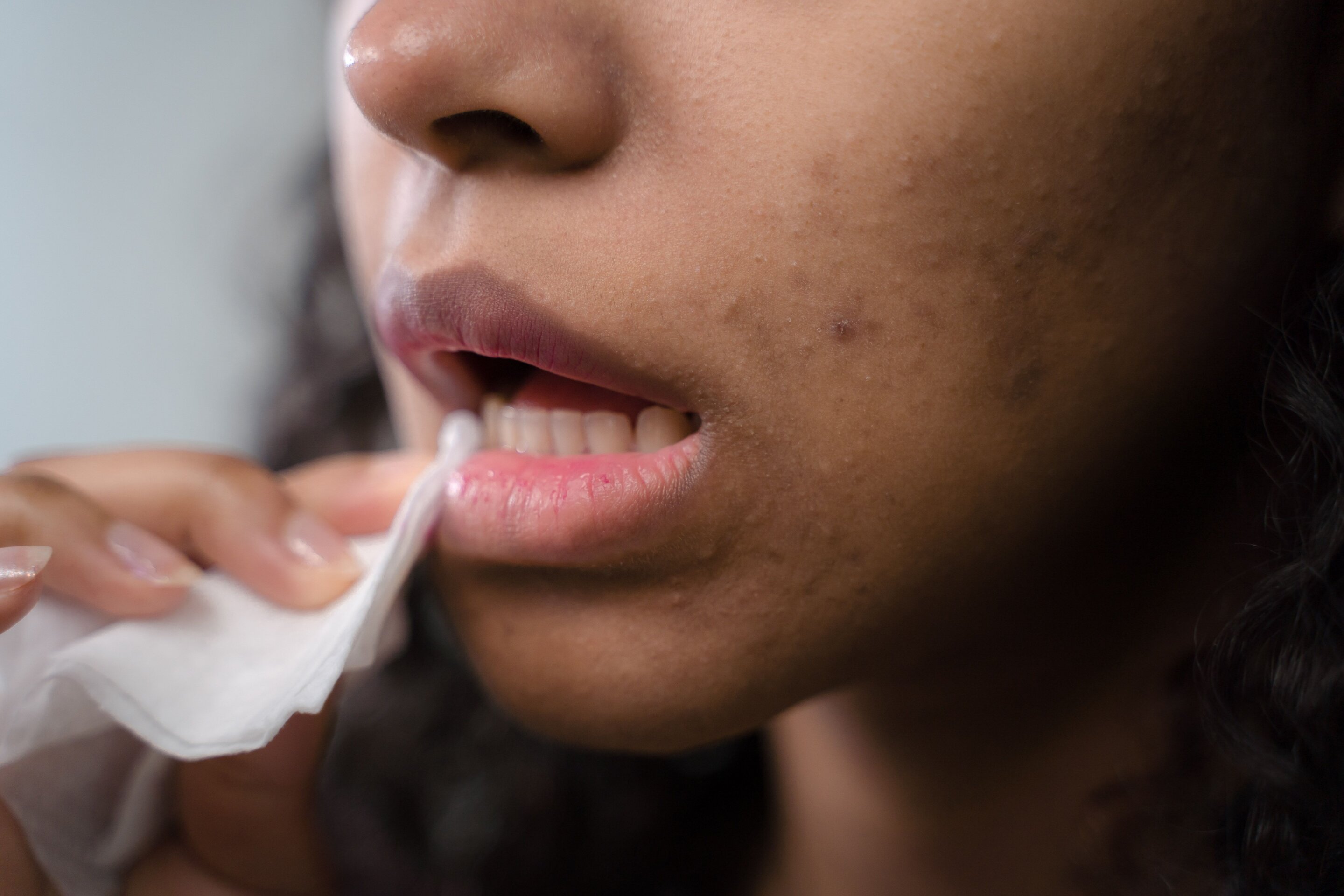 Why do I keep getting mouth ulcers?