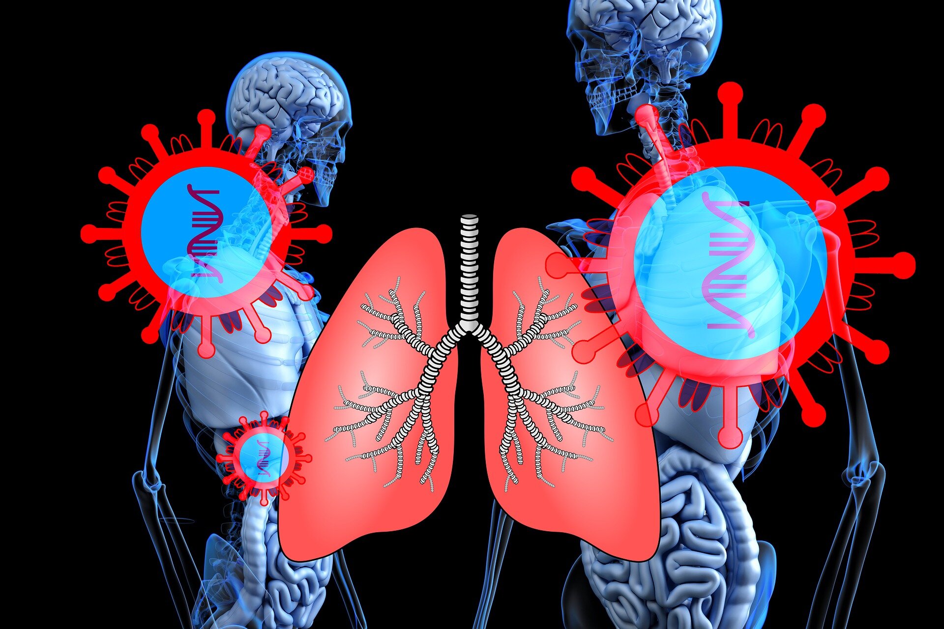 Spatial map of the lung reveals cellular mechanisms driving damage and fibrosis in severe COVID-19
