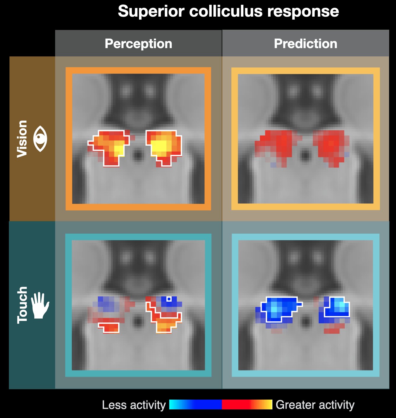 Tiny brain structure anticipates what we are about to see or feel, study finds