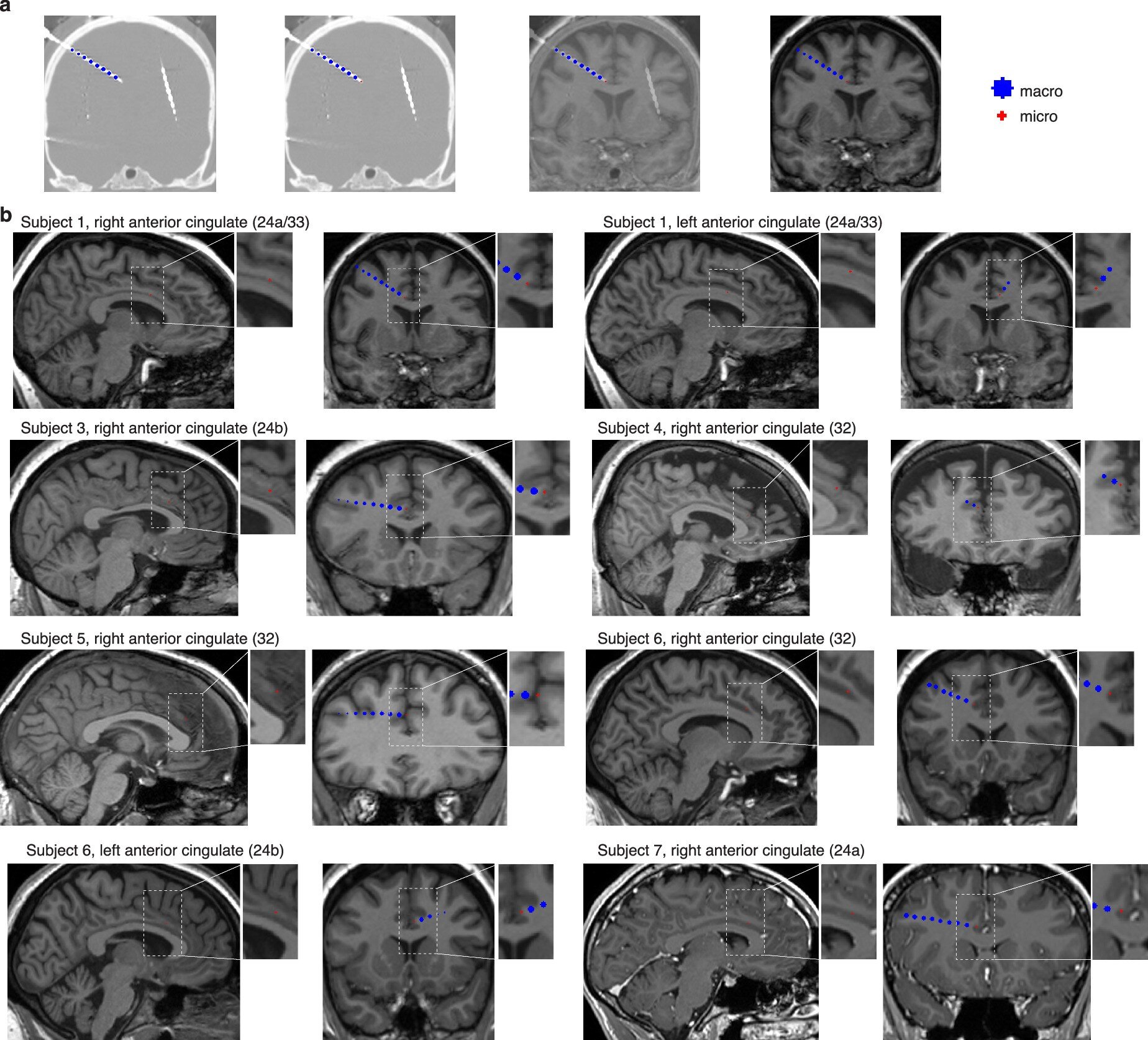 A poorly understood brain region tracks the gap between expectations and reality