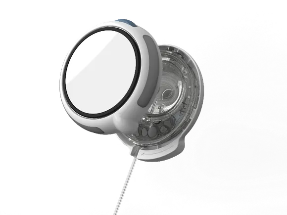 FDA clears Sequel’s insulin delivery system in Type 2 diabetes
