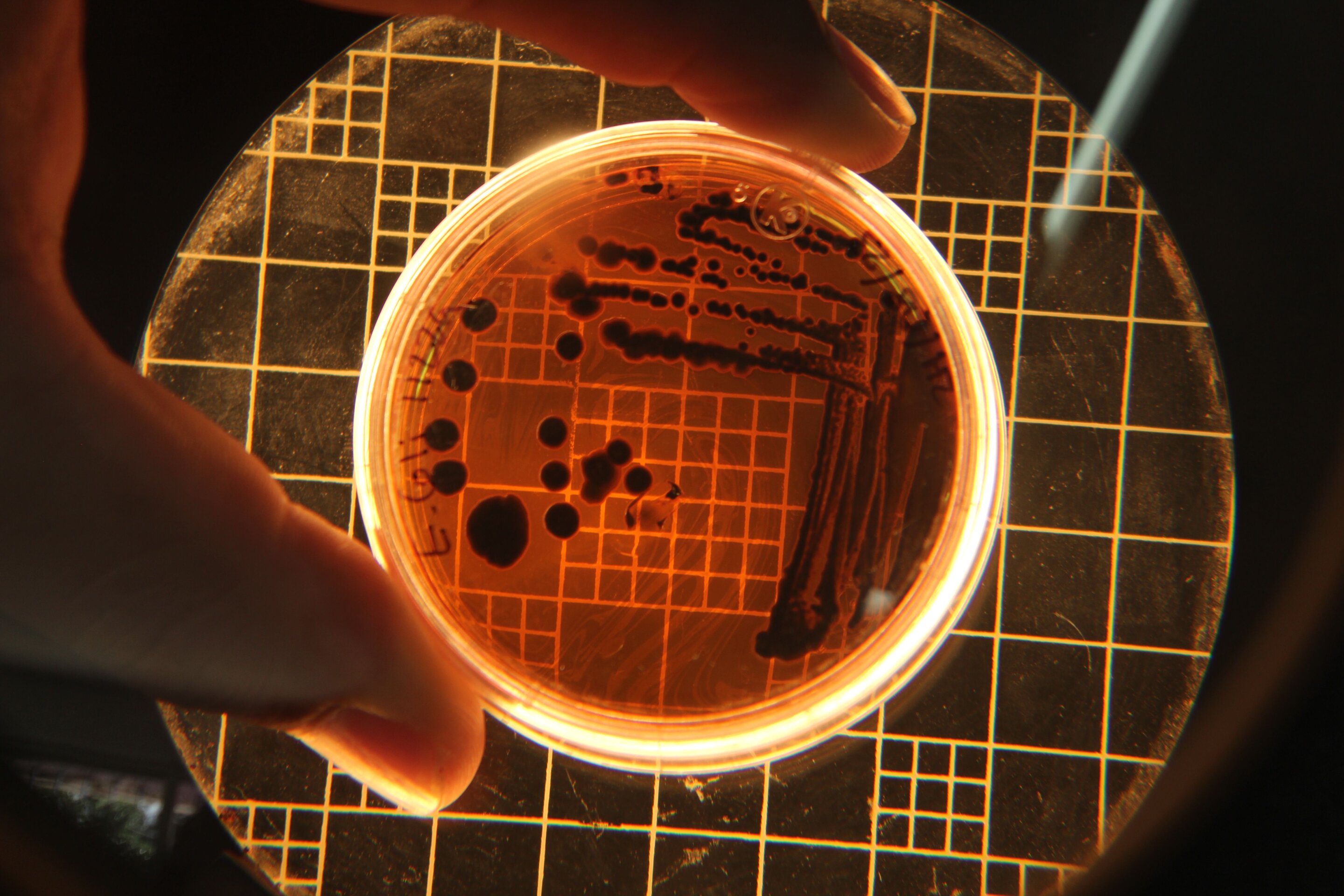 Second-ever case of rare fungus resistant to four antifungal drug classes detected in Kenya