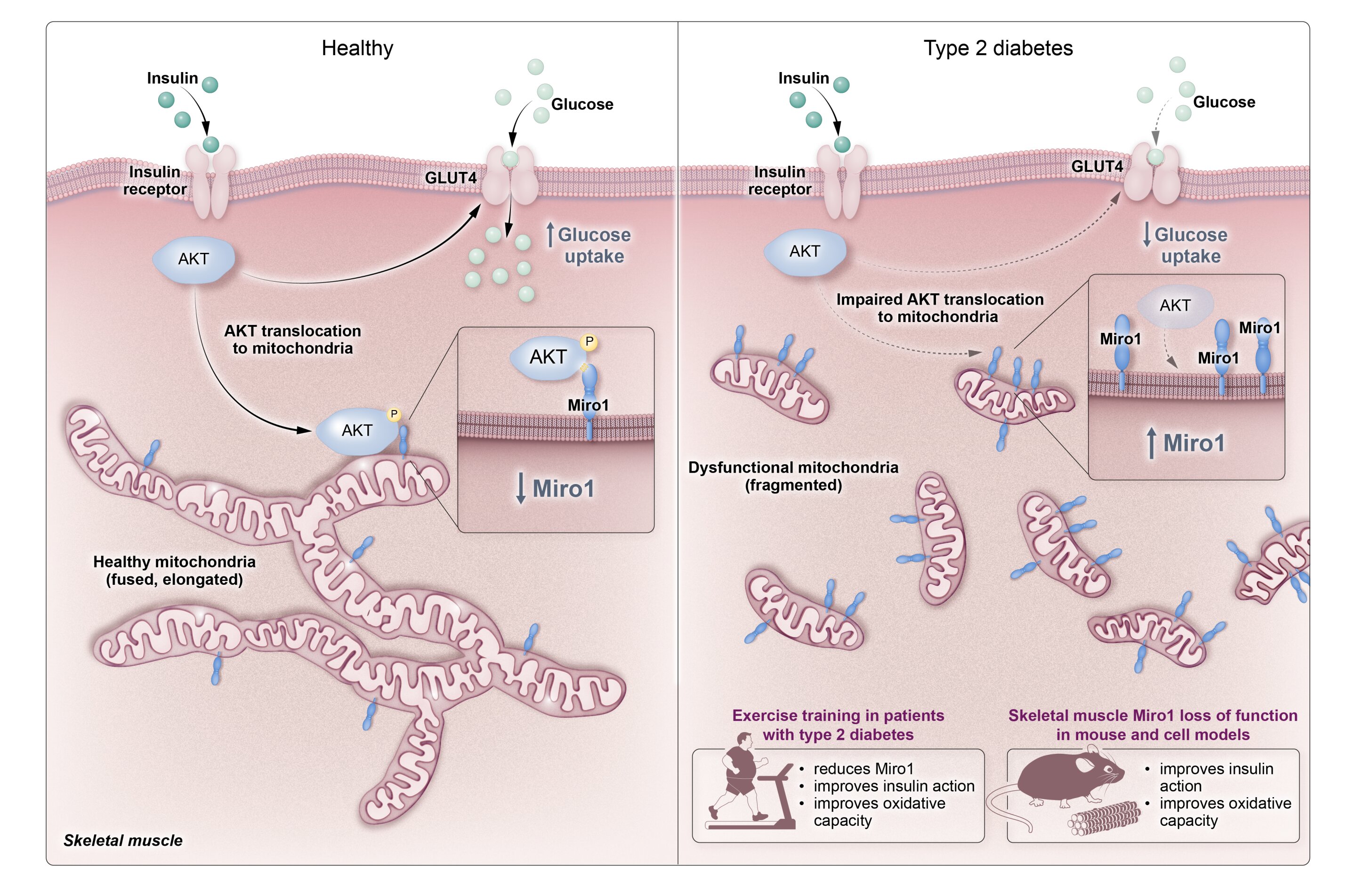 Muscle protein Miro1 may drive insulin resistance, revealing potential type 2 diabetes treatment target