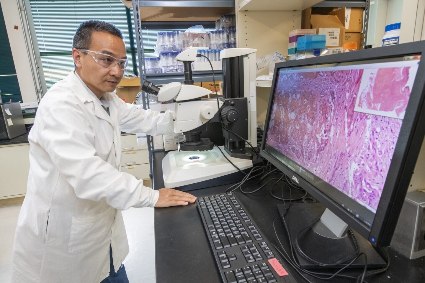 A simple blood test could reveal hidden radiation exposure