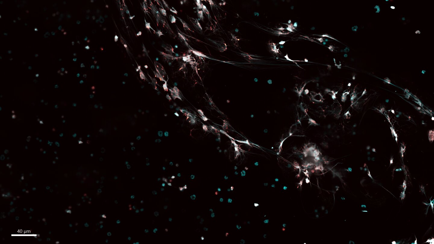 Embryos harbor immune cells that already perform adult-like defense functions, study suggests