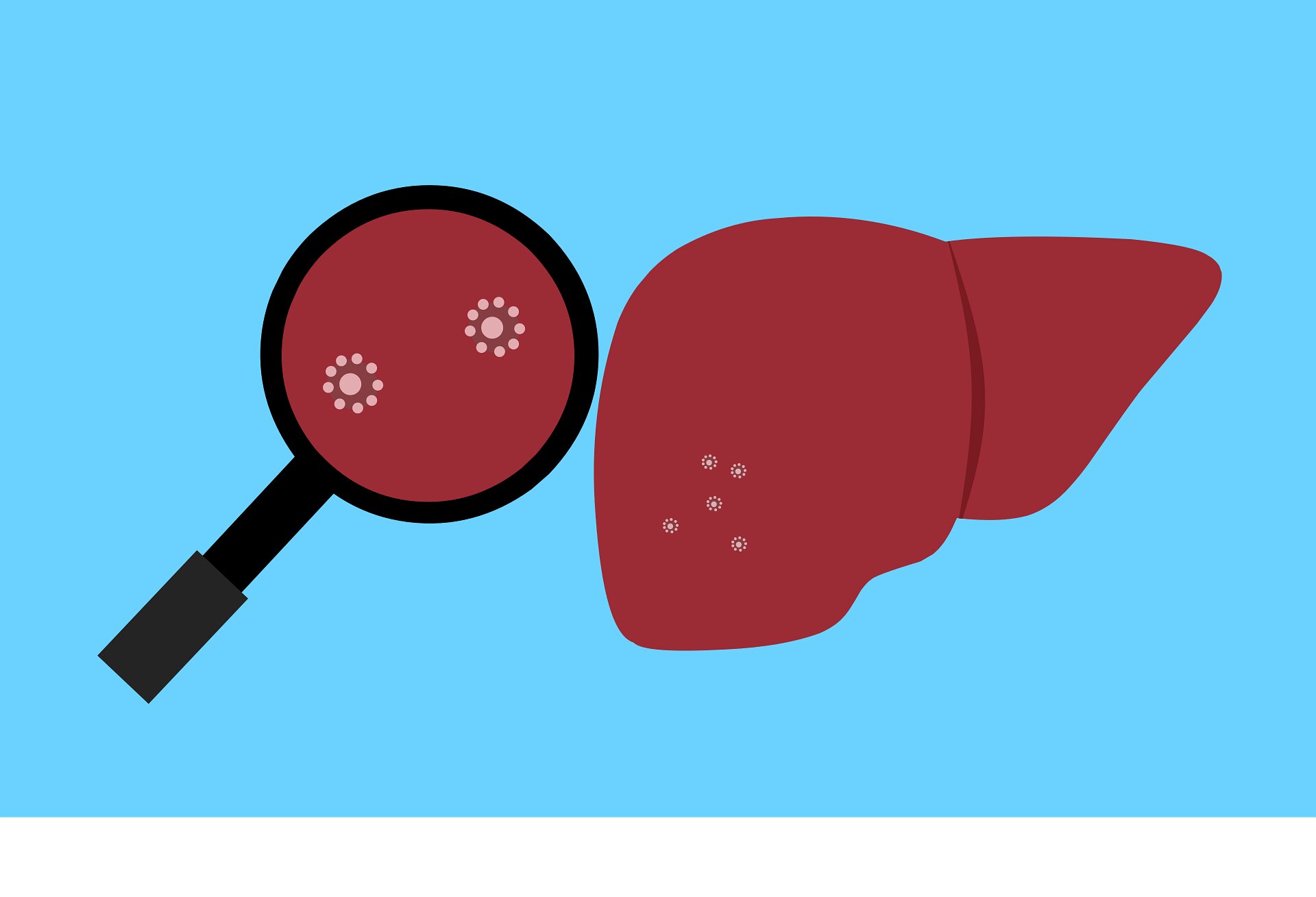 Routine liver cancer checks could extend lives below current screening thresholds for alcohol-related cirrhosis