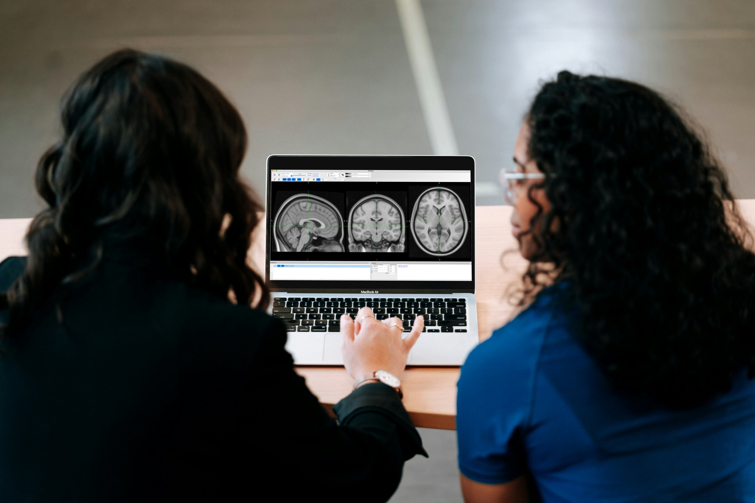 Gentle brain ultrasound may help ease delusions in schizophrenia