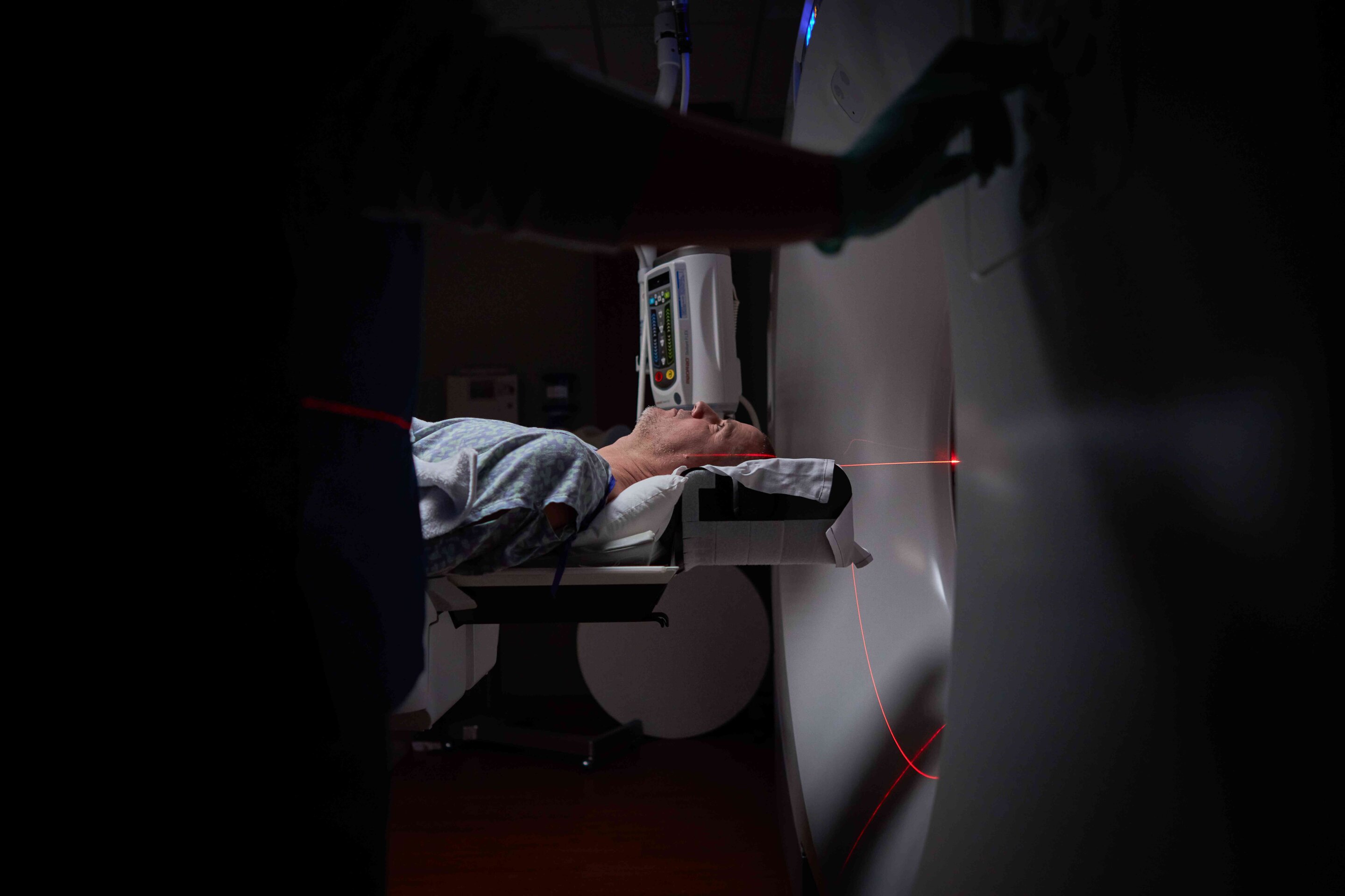 New study identifies immune trigger behind radiation-related lung damage