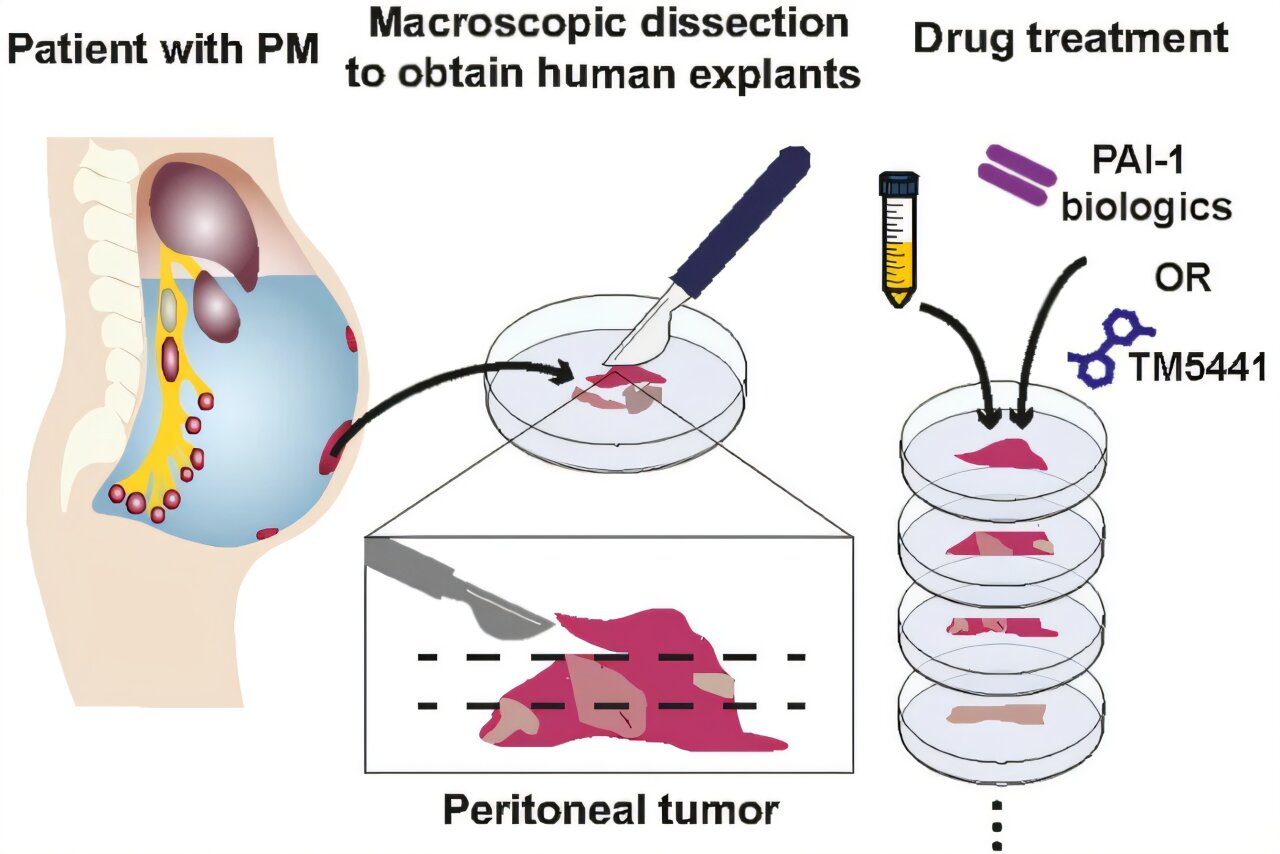 Research team develops novel nanobody targeting tumor-fueling fluid to treat late-stage cancer of abdominal lining