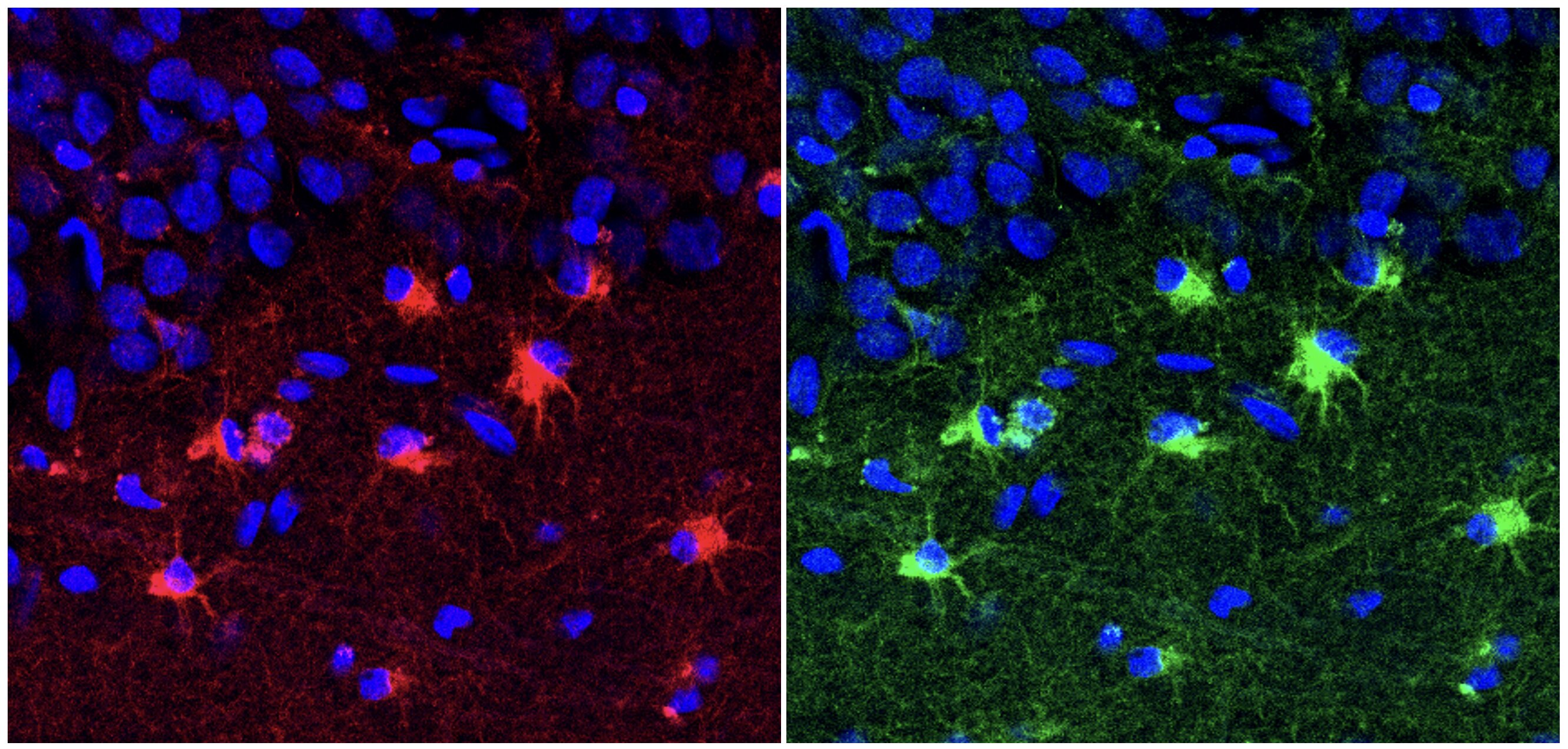 Immature brain support cells may be linked to human age-related cognitive decline