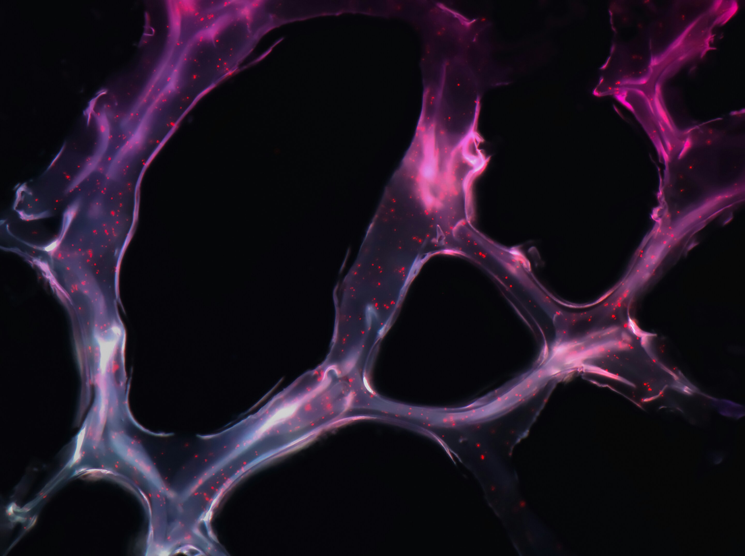 AI is helping pathologists find harmful lesions the eye can't see
