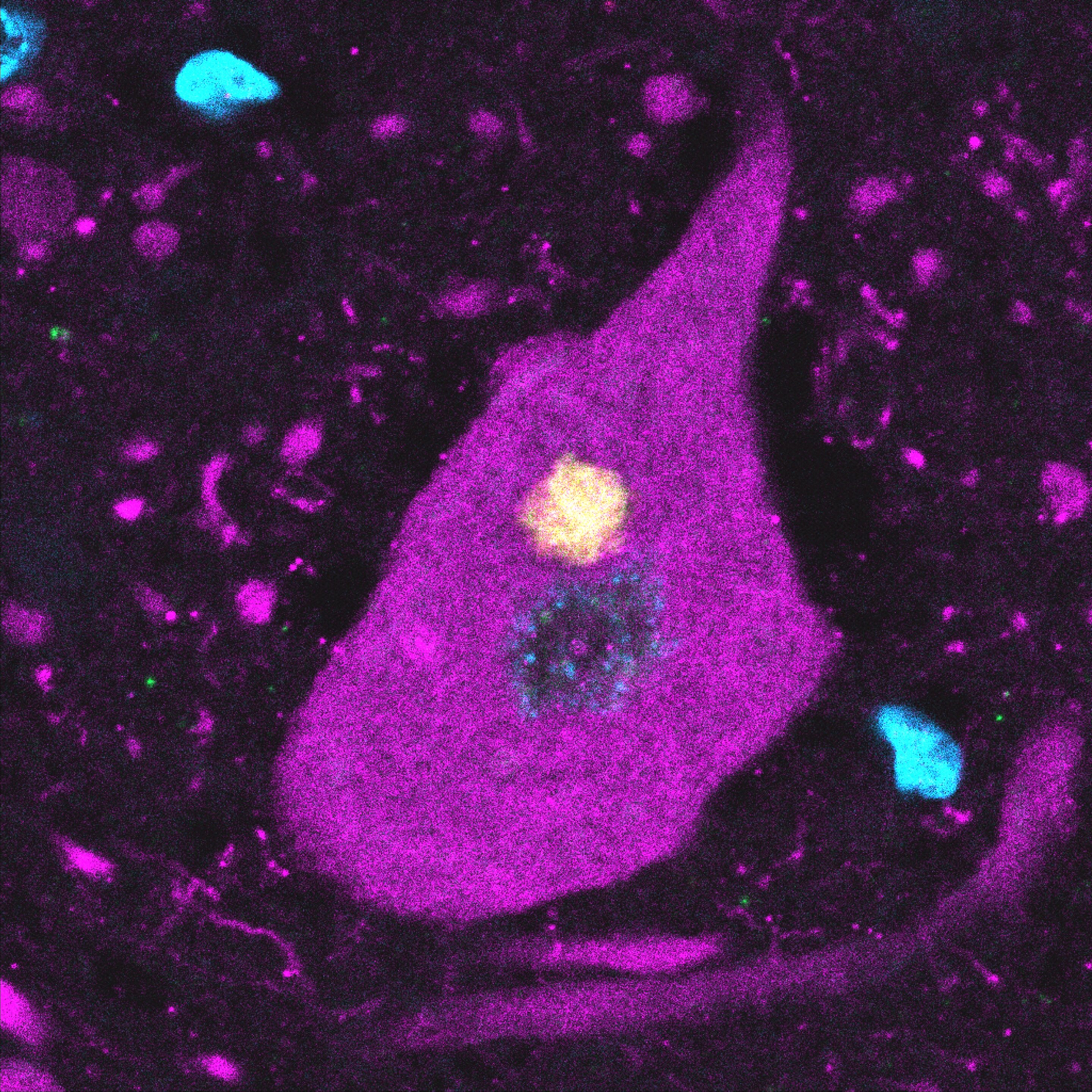 Motor neurons activate unexpected defense to clear ALS-linked protein before it clumps