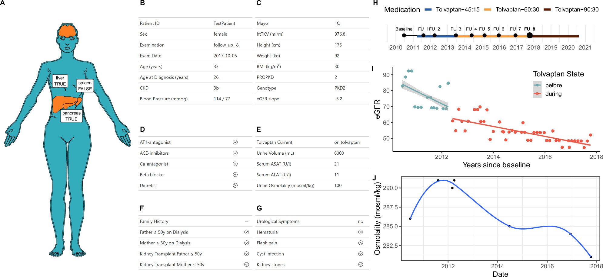 New platform unites polycystic kidney disease data for near-real-time analysis