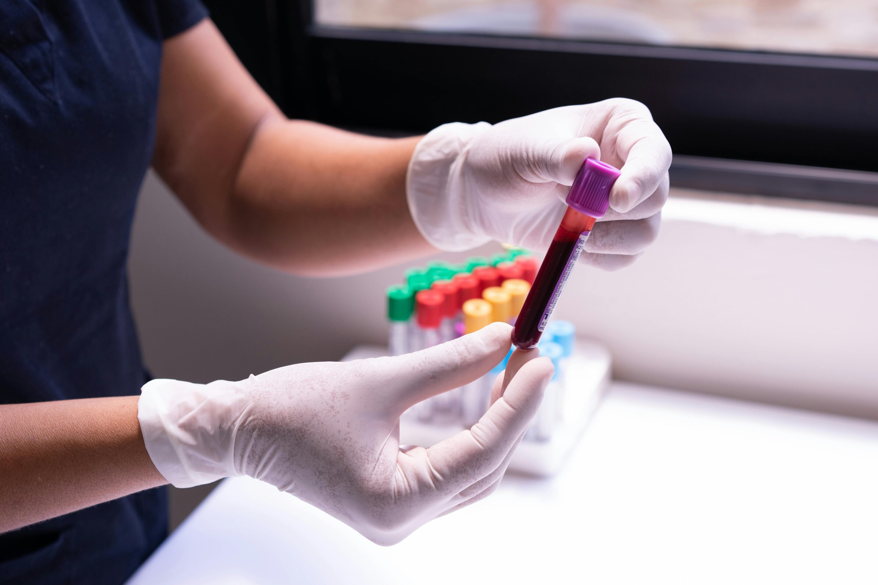 Daily blood tests flag potential to stop sepsis antibiotics nearly two days early