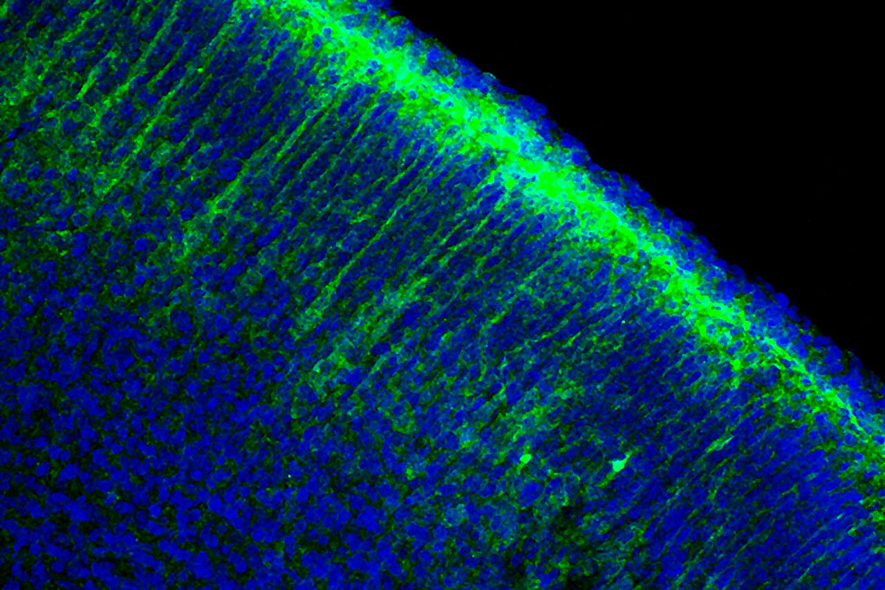 Buildup of normally harmless enzyme stunts brain growth in mice with Angelman syndrome