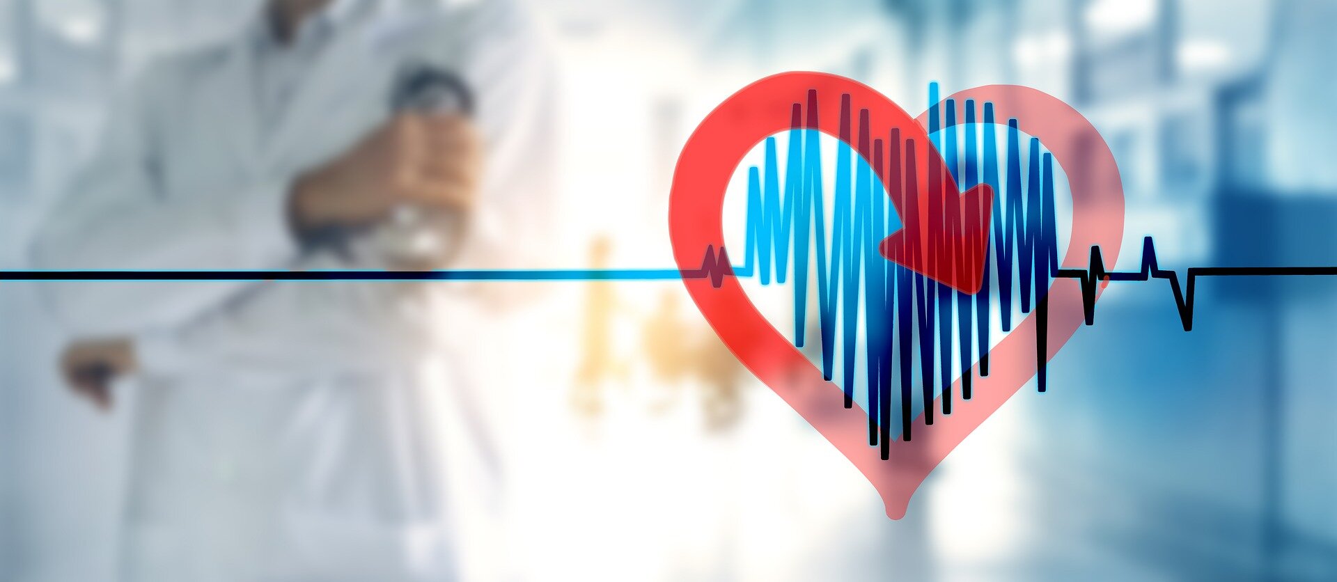 Newer anticoagulants may help prevent strokes in AFib patients with previous brain bleeds
