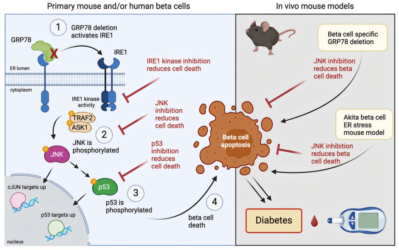 Blocking a cellular stress pathway may help preserve insulin-producing cells