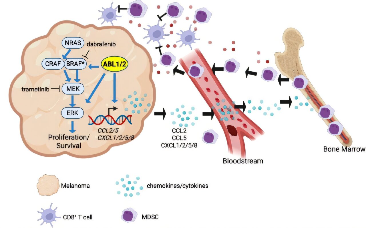 Study reveals how melanoma outmaneuvers both drugs and immune defenses
