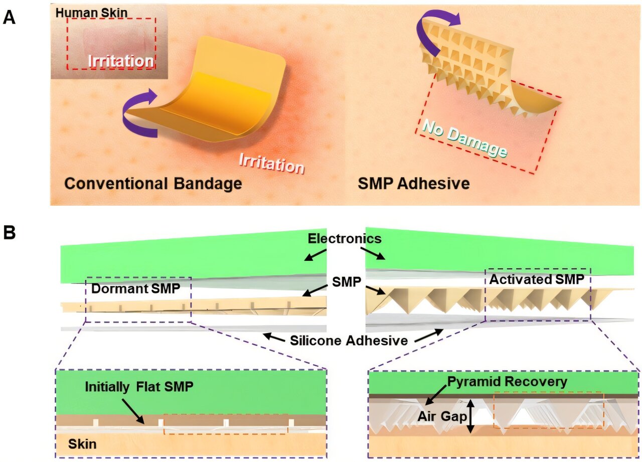 Smart adhesive patch sticks securely and releases gently without damaging skin