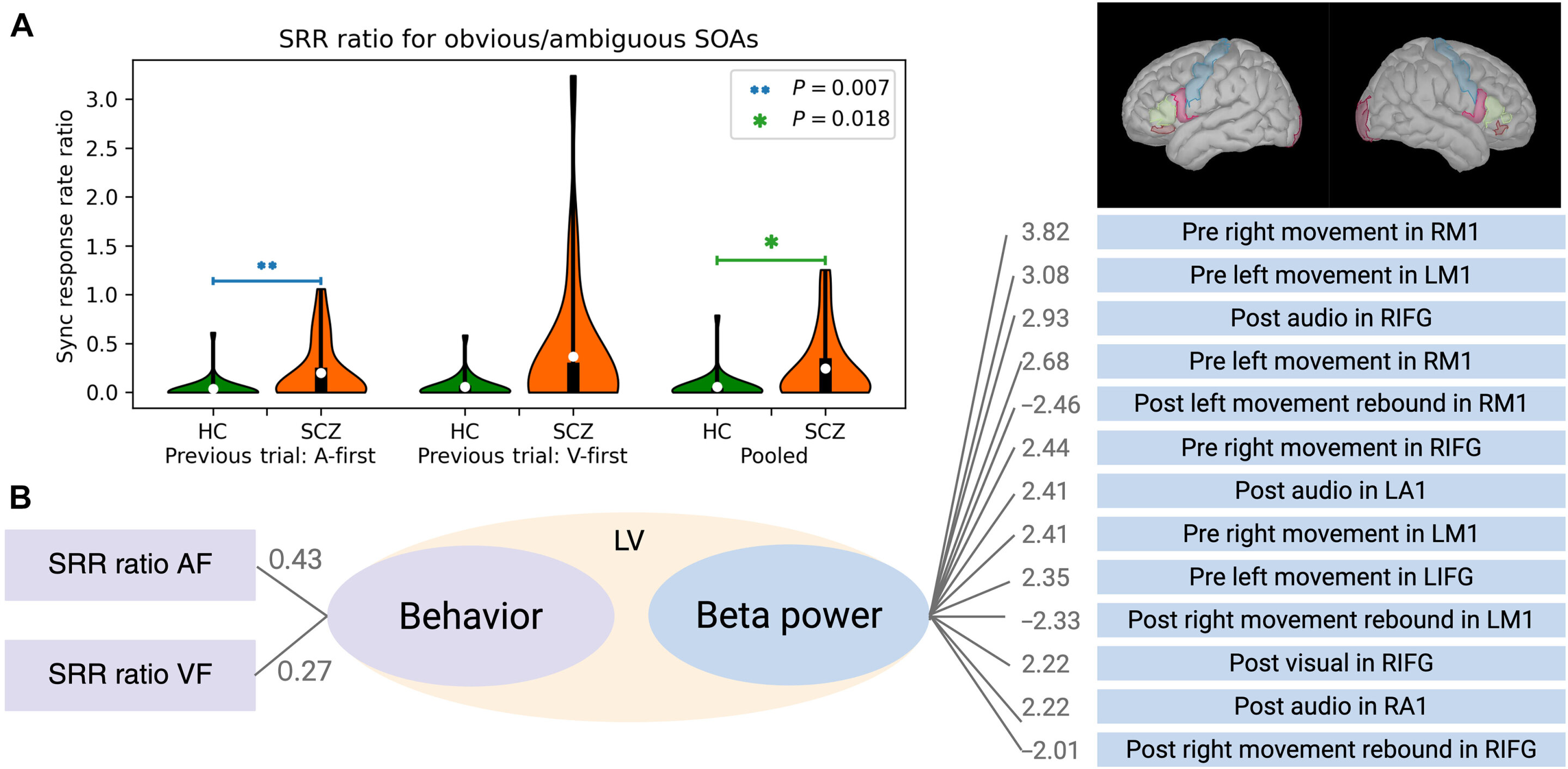Imaging study links several schizophrenia symptoms to a single brain signal