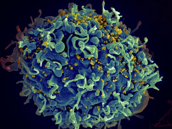 International study helps support FDA approval of HIV drug for newborns