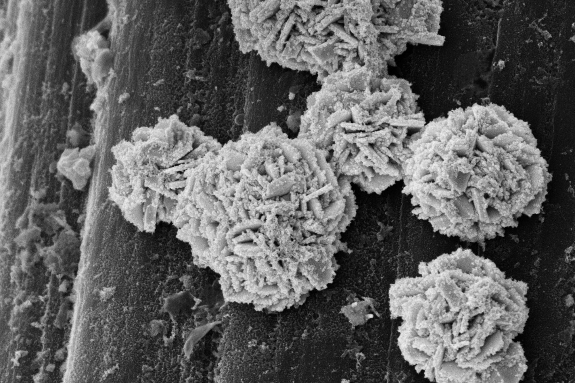 Tackling diabetes with an electronic implant: How a tiny catalyst lowers blood sugar