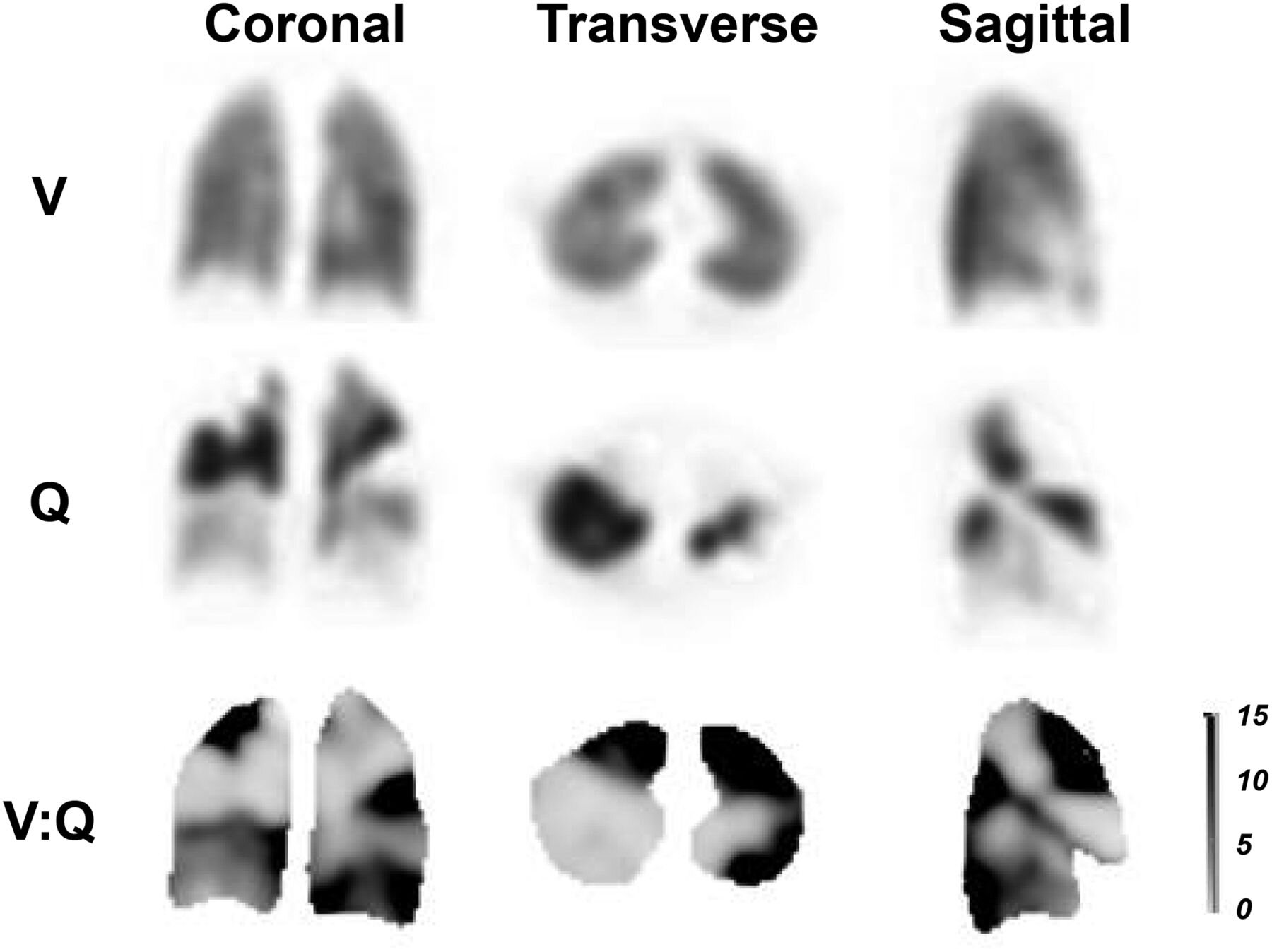 Procedure standard/procedure guideline for ventilation–perfusion pulmonary scintigraphy published