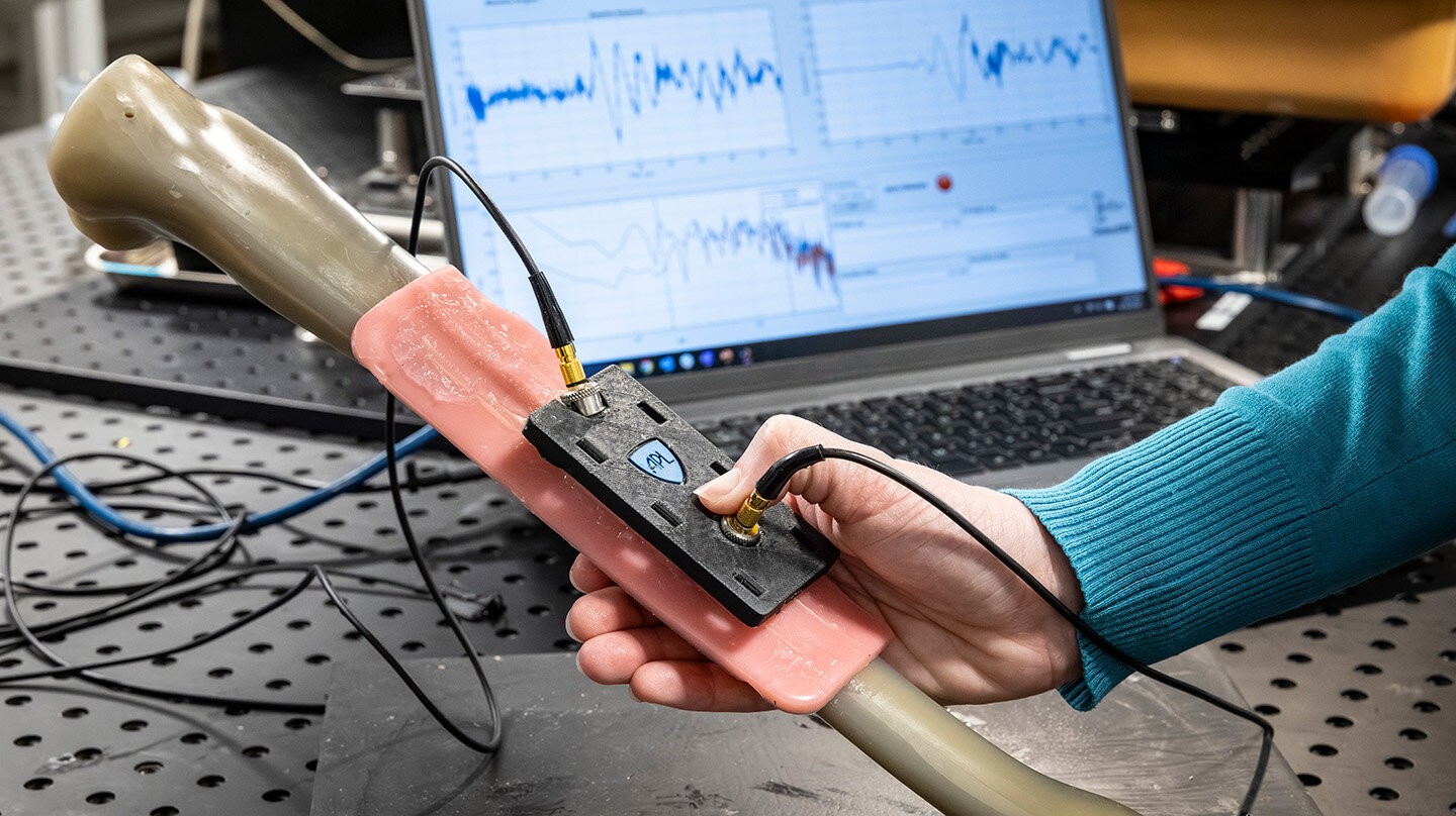 Ultrasonic technology enables earlier stress-fracture detection