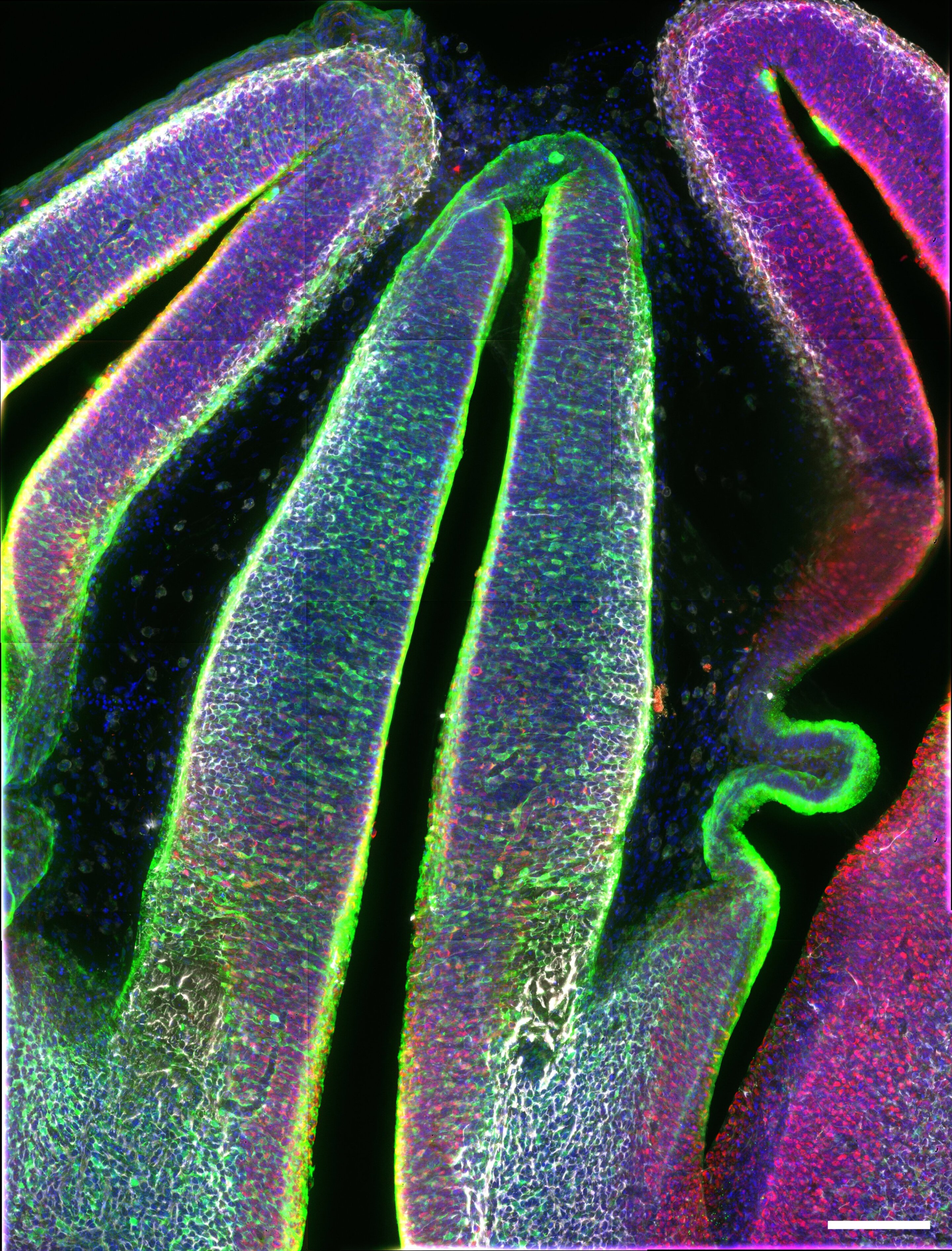 Multiomic atlas of the developing thalamus reveals how neuronal identities emerge