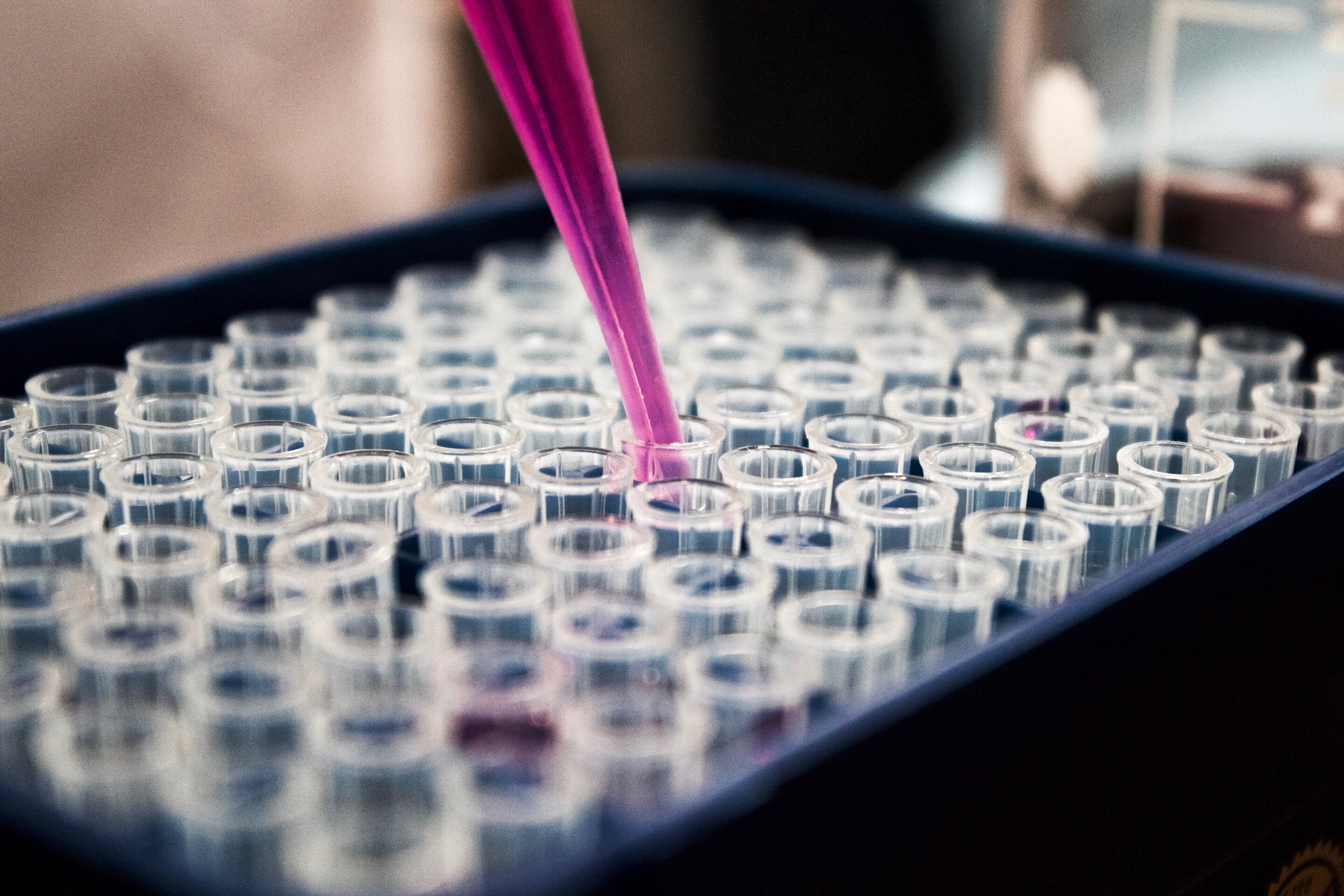 Biomarkers identified for cytokine release syndrome risk after CAR T-cell therapy