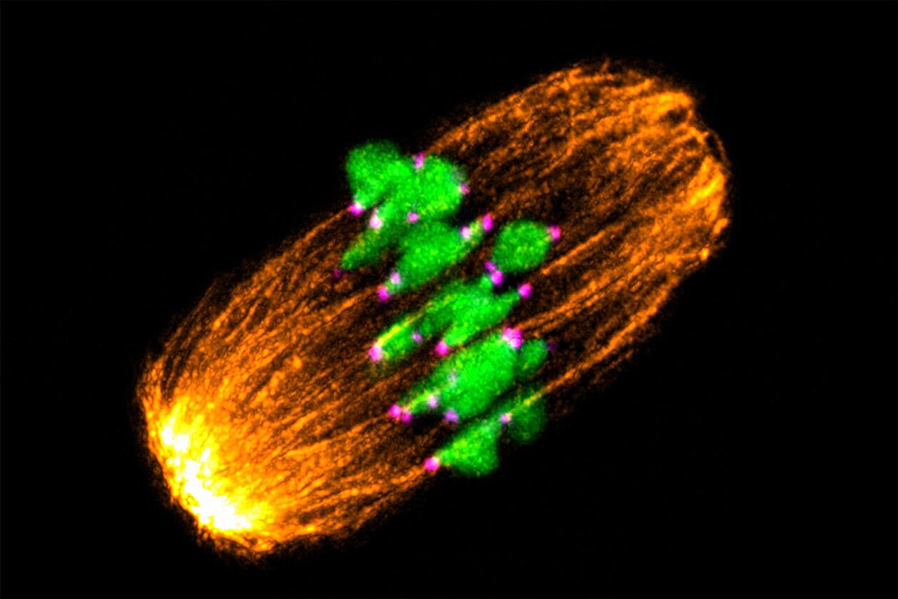 Weakened chromosome anchors may help explain age-related declines in egg quality